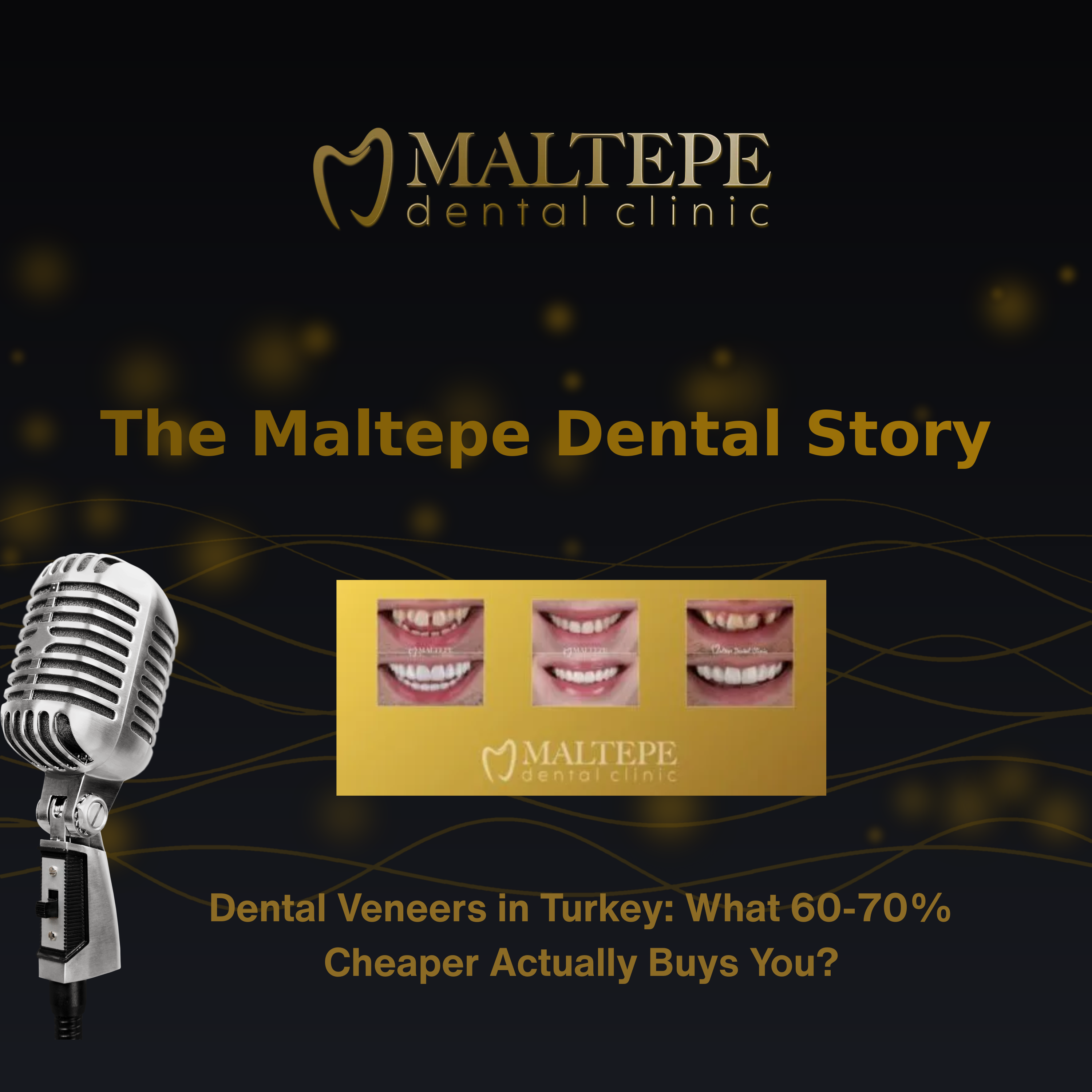 Dental Veneers in Turkey: What 60-70% Cheaper Really Buys? episode artwork