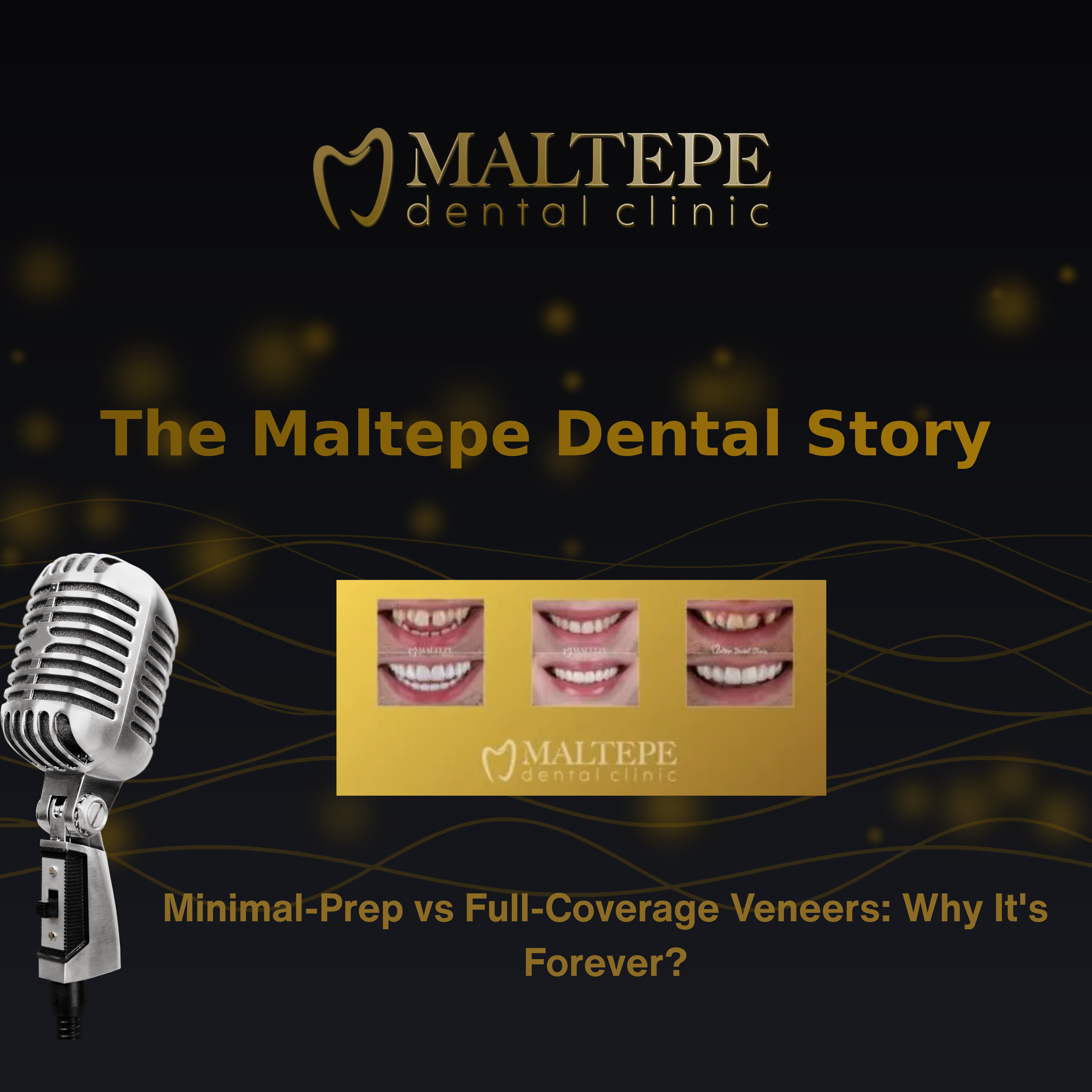 Minimal-Prep vs Full-Coverage Veneers: Why It's Forever? episode artwork