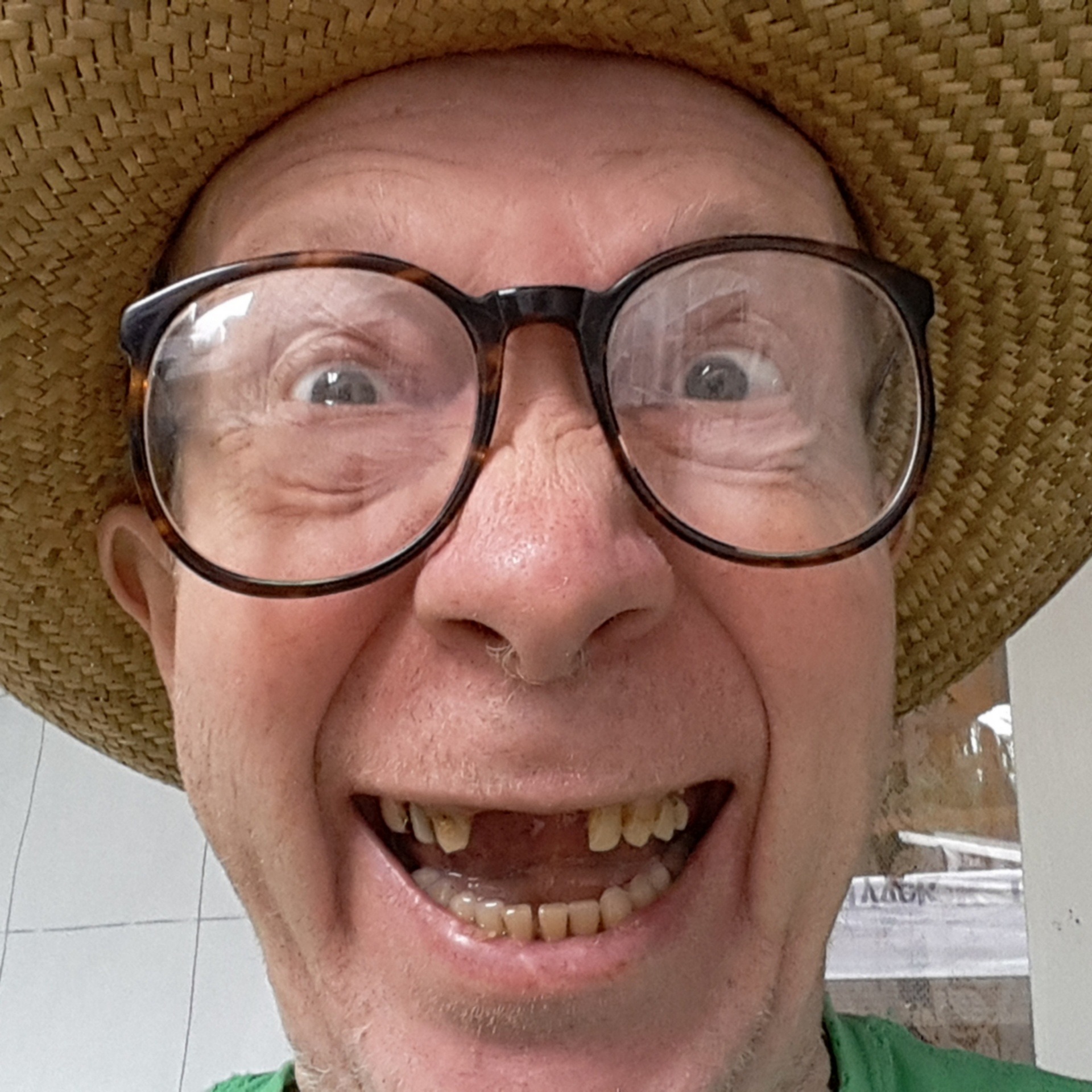 ADDBIBLE® Exodus 21 - An Eye for Eye, a Tooth for Tooth