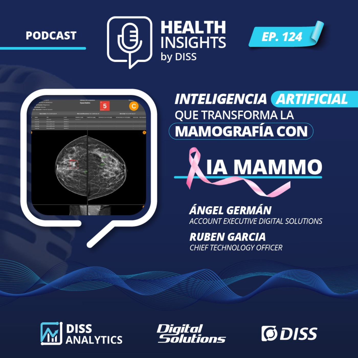 Inteligencia Artificial Que Transforma la Mamografía con IA MAMMO