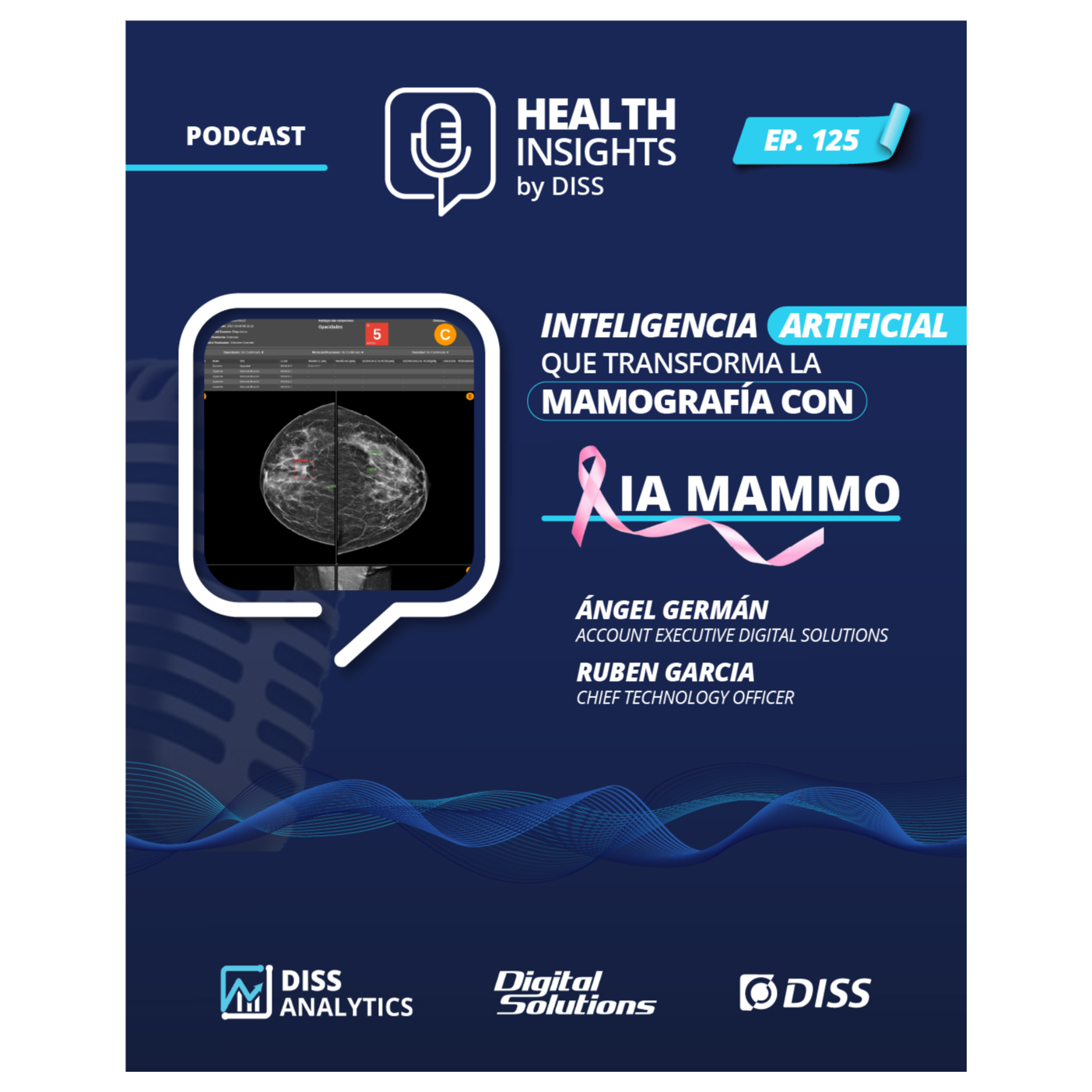 Inteligencia Artificial Que Transforma la Mamografía con IA MAMMO Episode 125