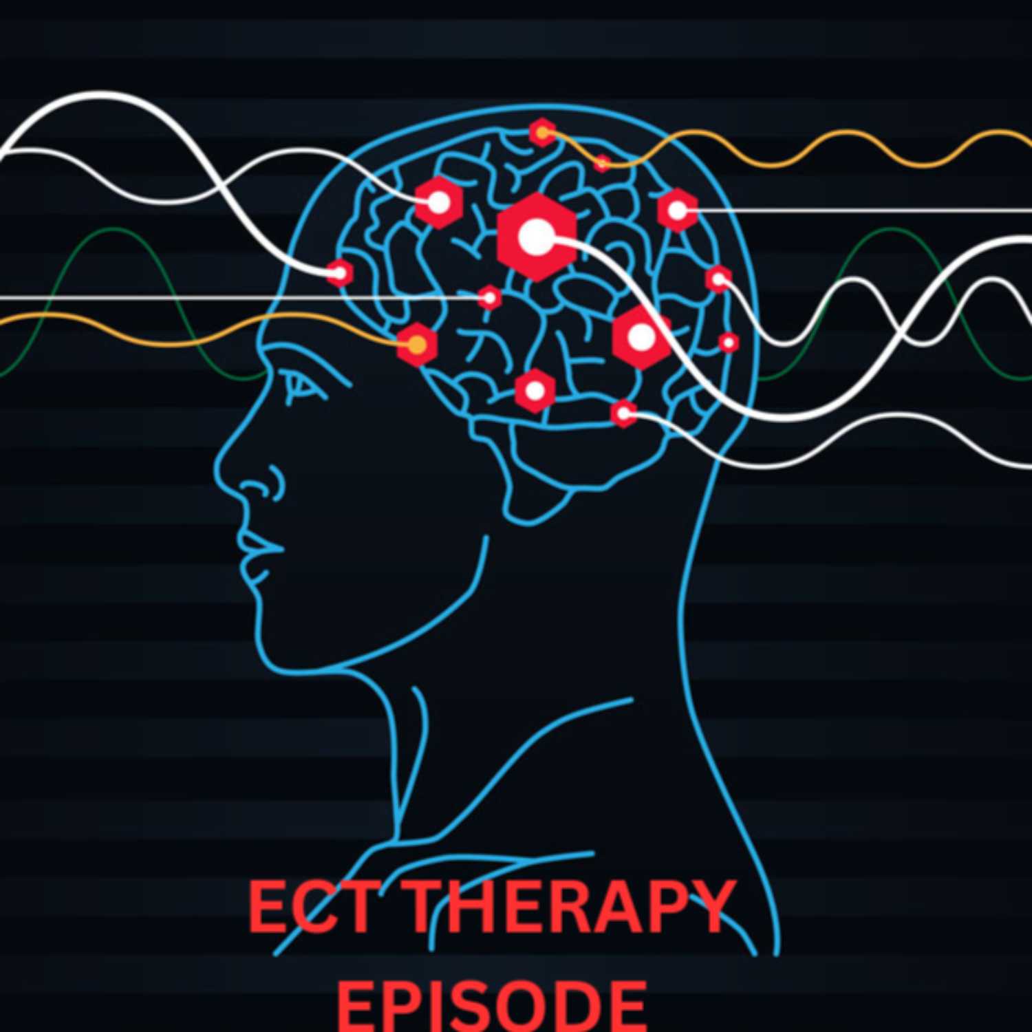 I'm trying ECT Therapy