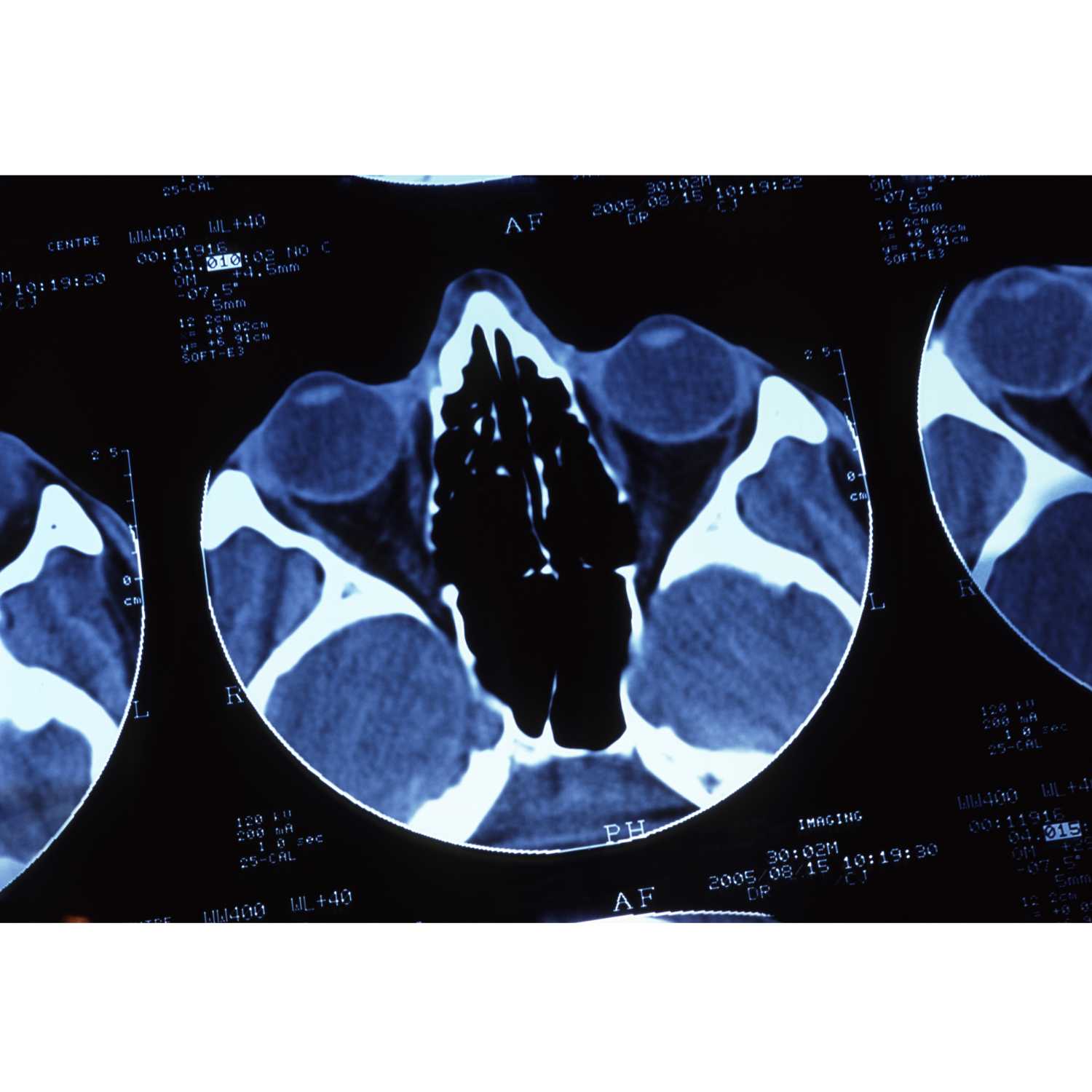 Medical Imaging Techniques