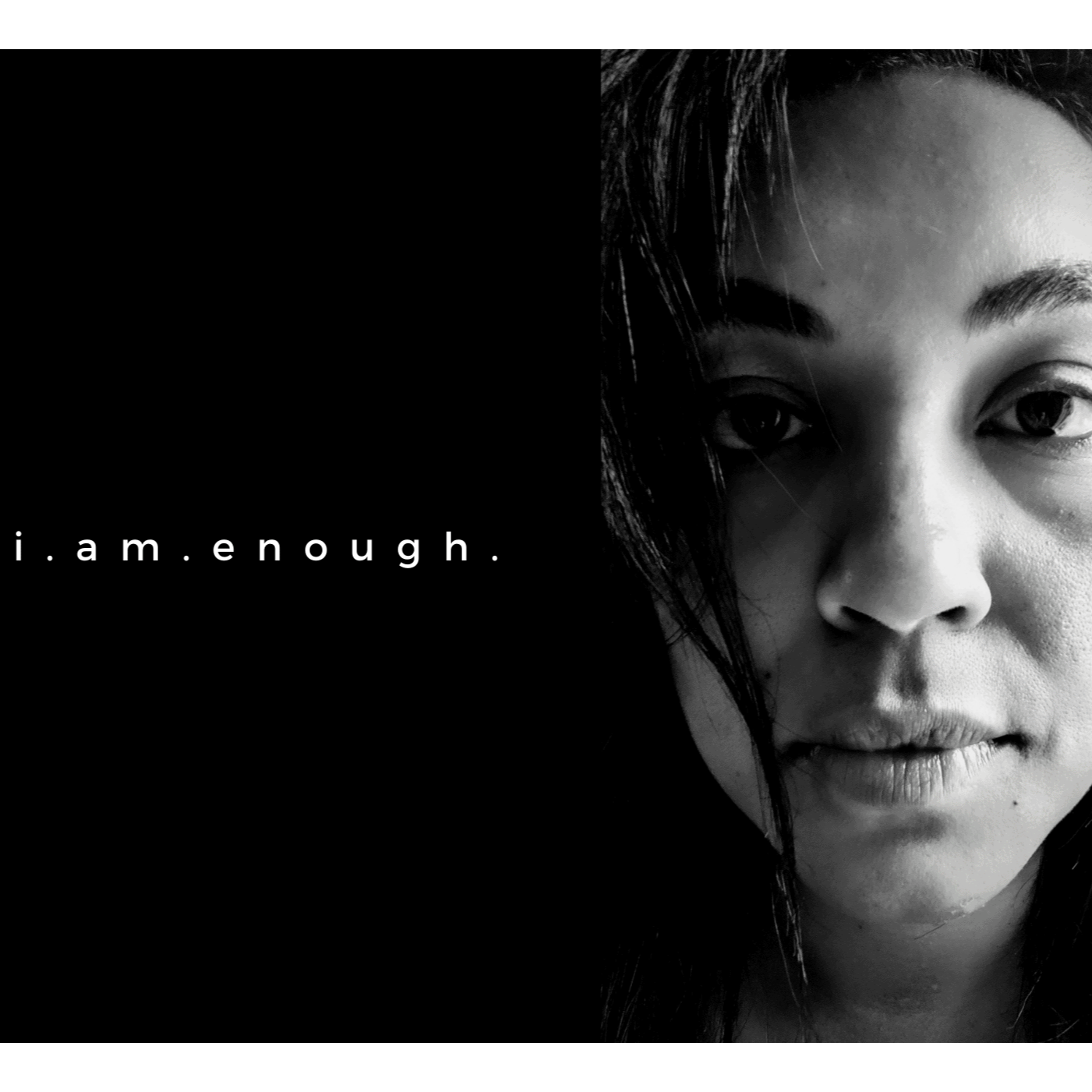 Mental Health and the Effects of Albinism 