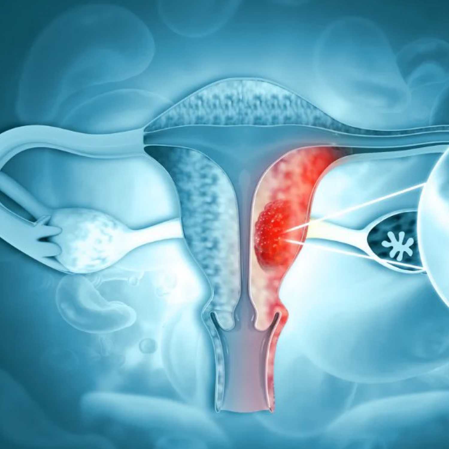 CÁNCER DE CUELLO DE ÚTERO - Dra. Natalia Pérez - BUENVIVIR episode artwork