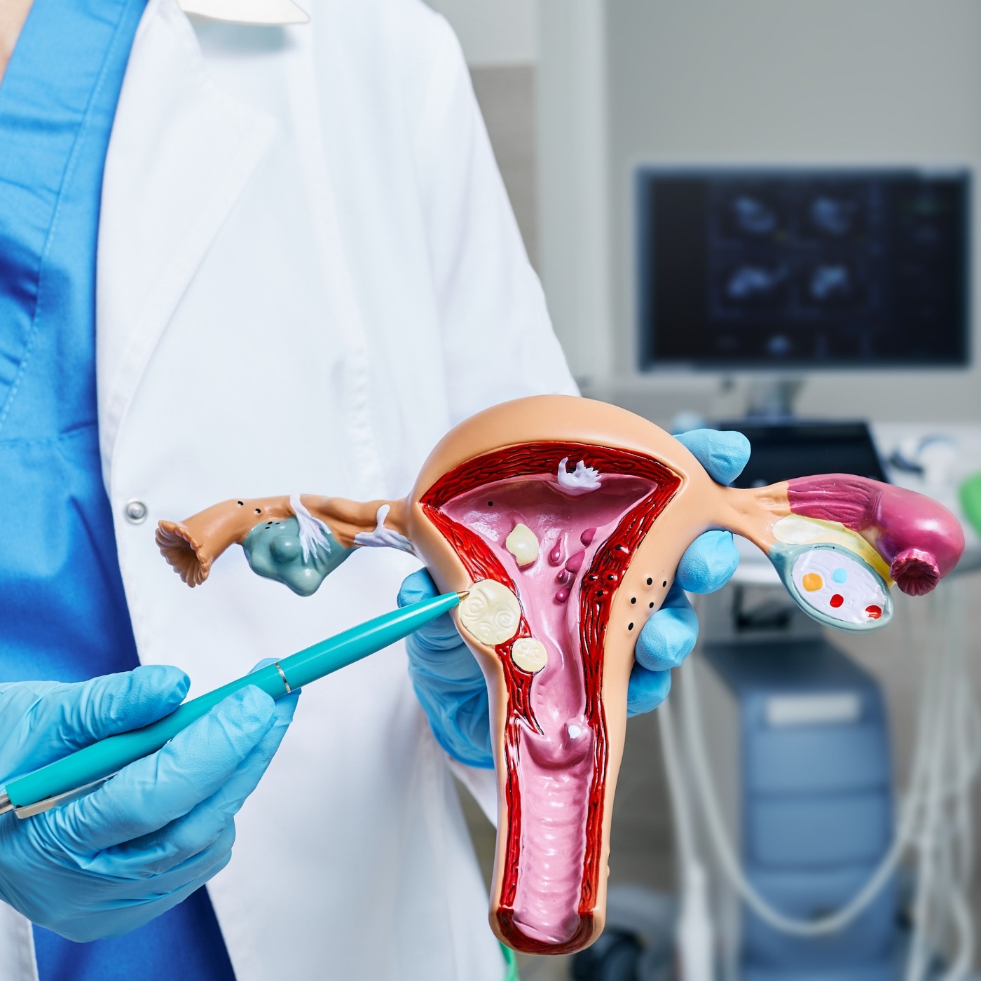 Top Treatments for Fibroids Recommended by Specialists episode artwork