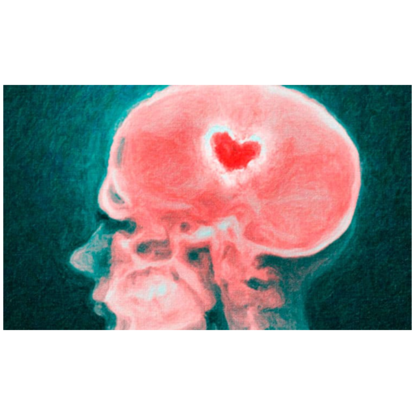 Como funciona el cerebro cuando esta enamorado  episode artwork