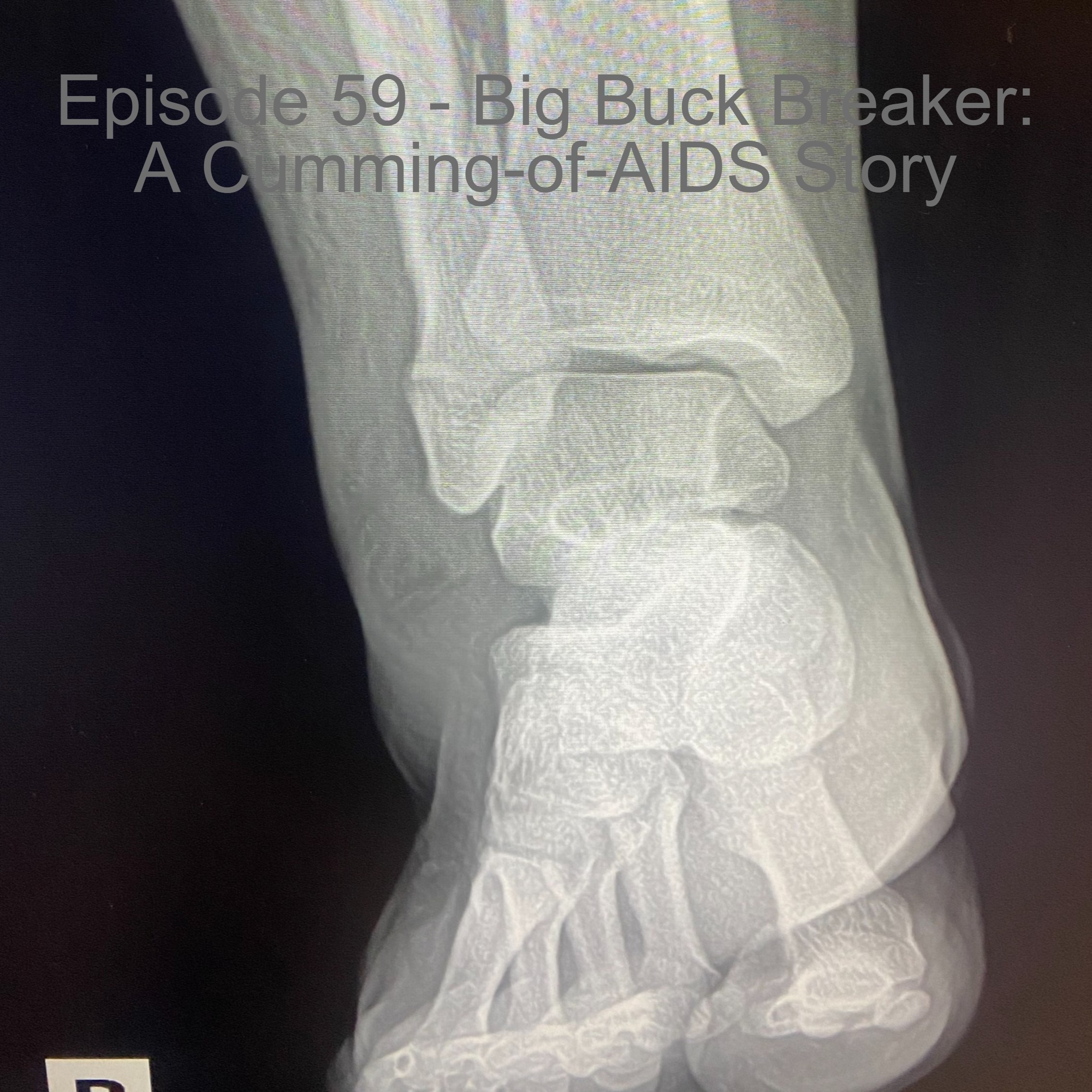 Episode 59 - Big Buck Breaker: A Cumming-of-AIDS Story episode artwork