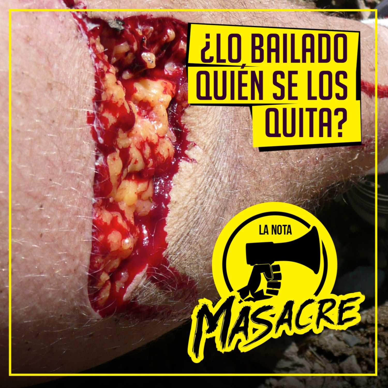 LA NOTA MASACRE