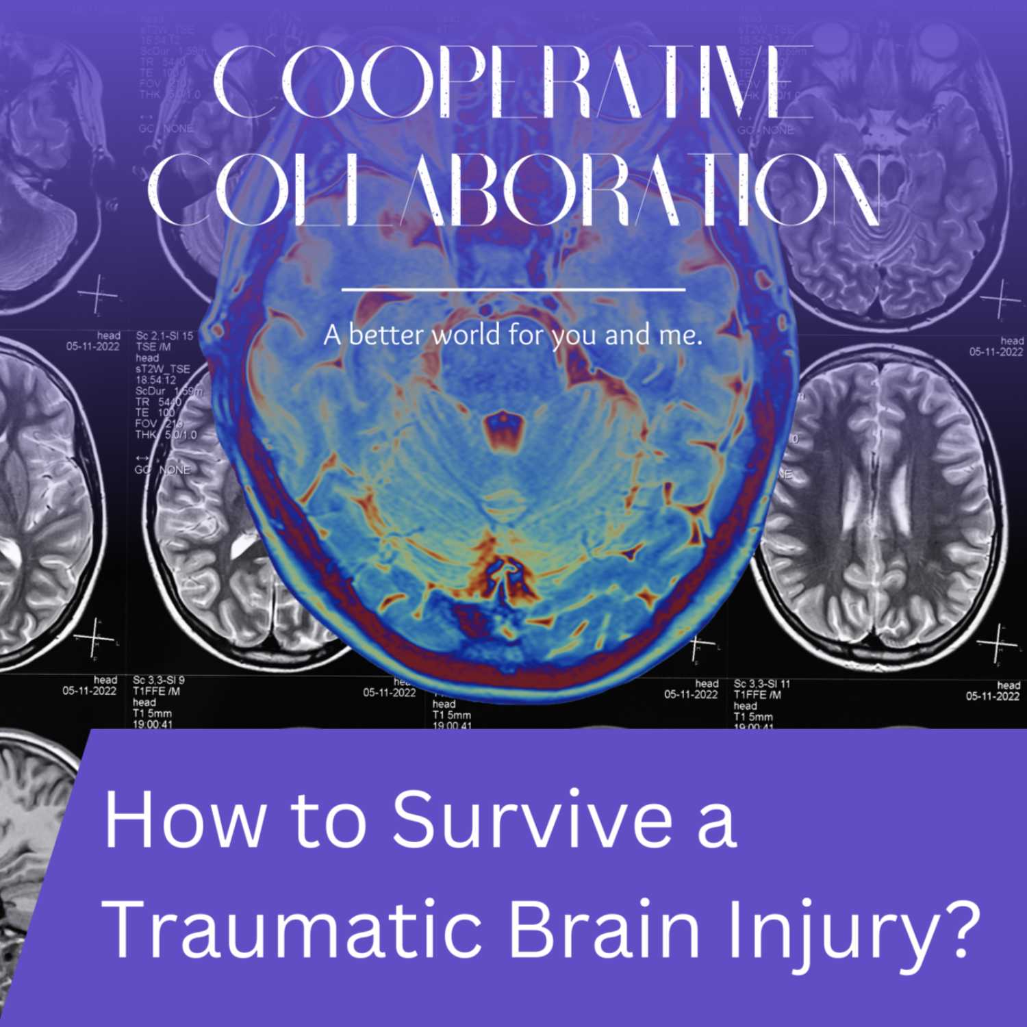 101: How to Survive a Traumatic Brain Injury? | EP #1 episode artwork