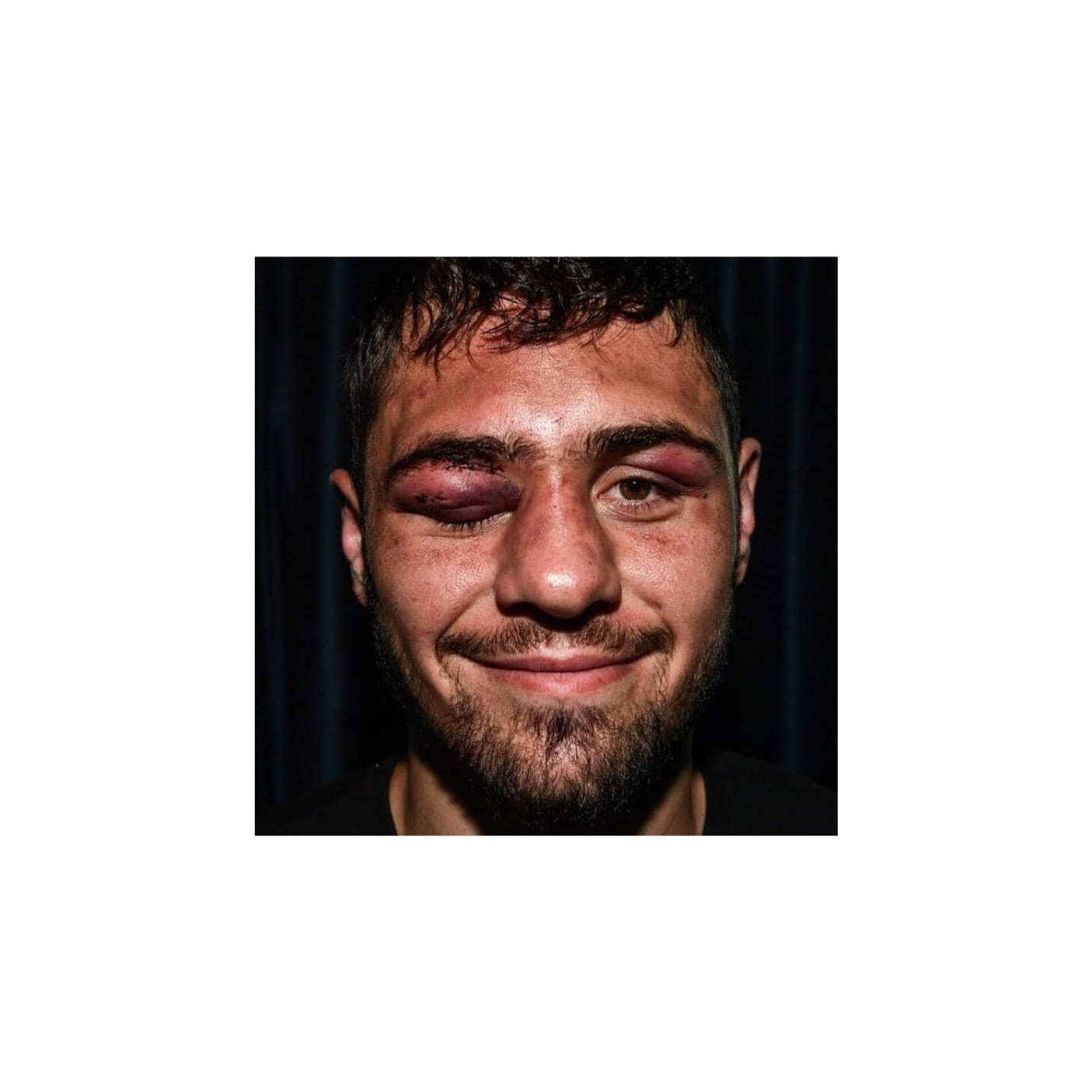 Dave Allen\'s boxing talk