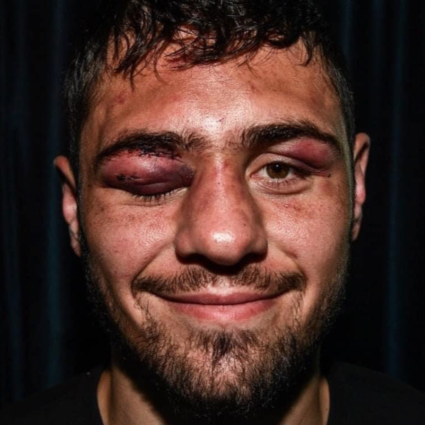 Dave Allen\'s boxing talk