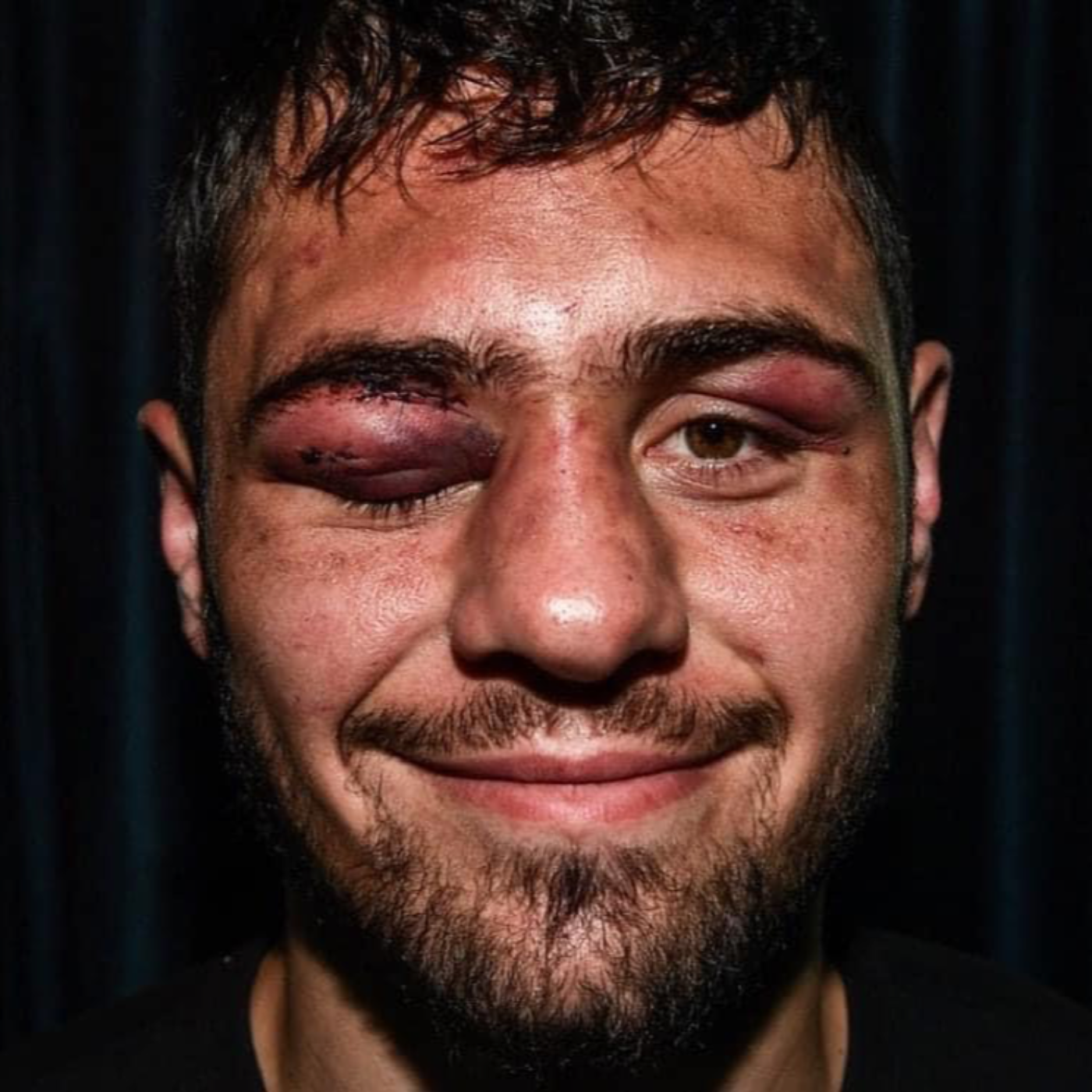 Dave Allen\'s boxing talk