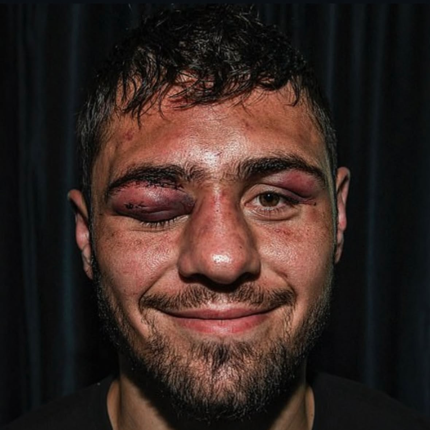 Dave Allen\'s boxing talk