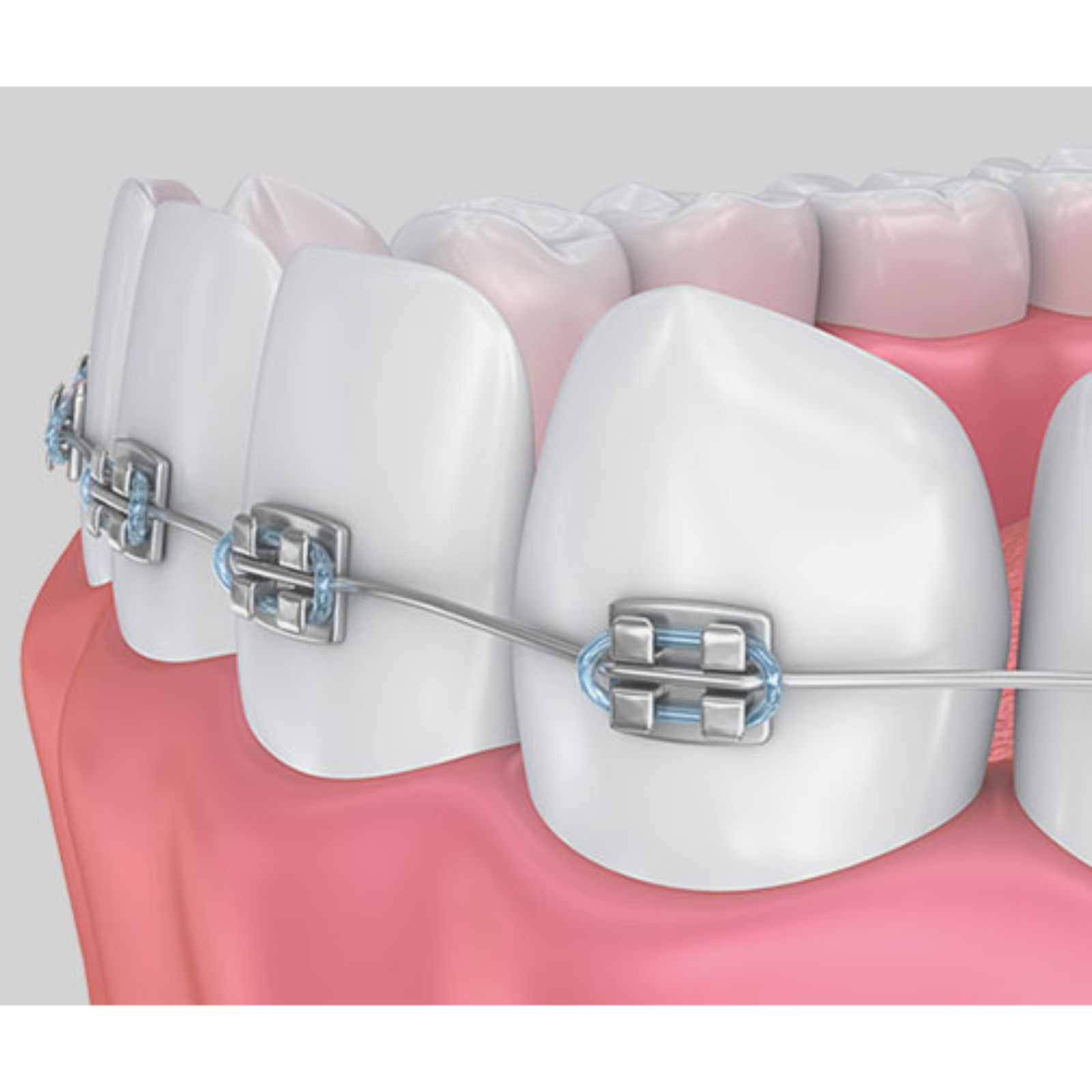 Orthodontics episode artwork