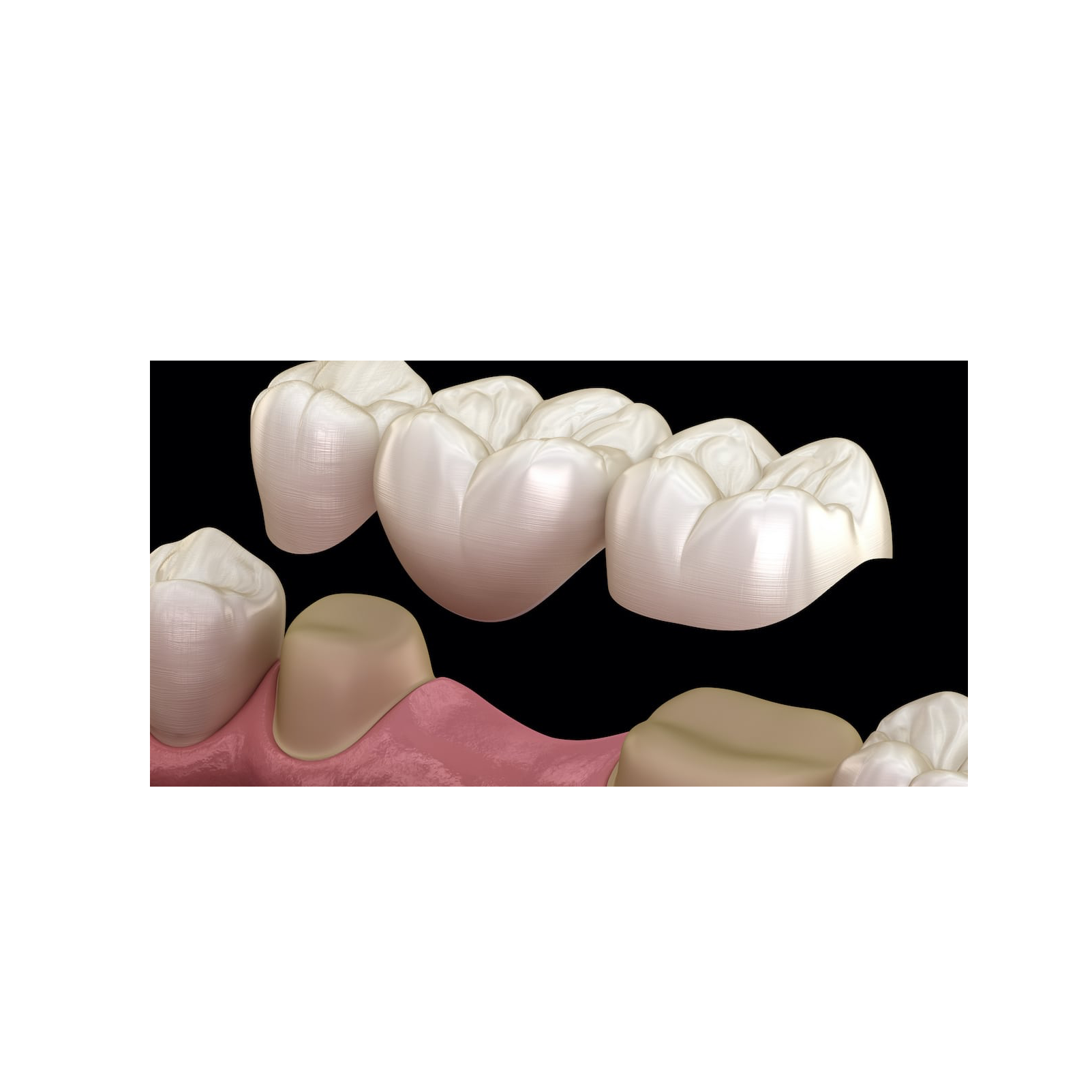 Prosthodontics episode artwork