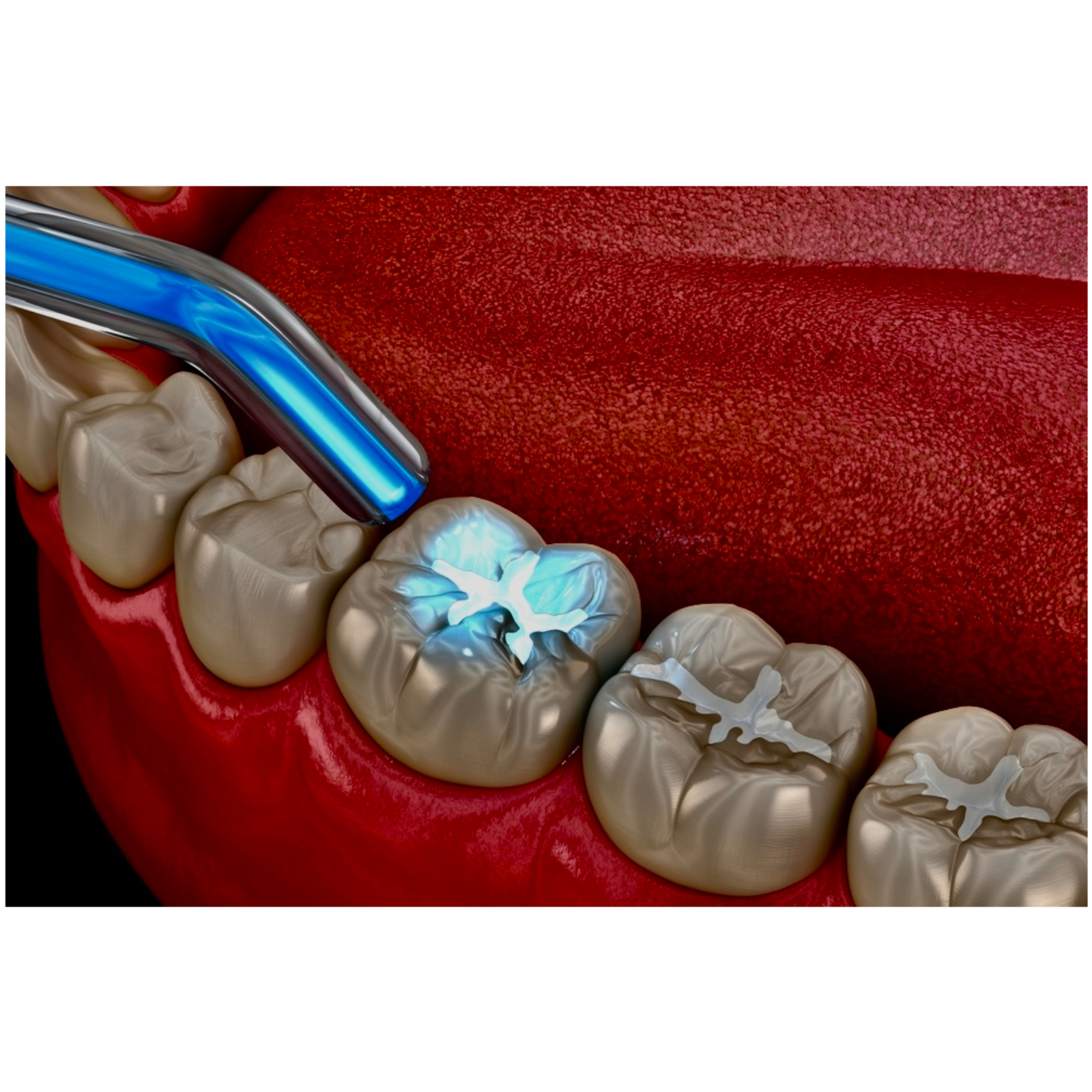 Operative dentistry episode artwork
