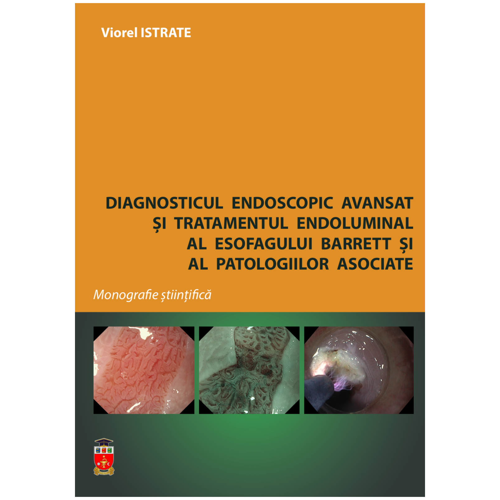 Diagnosticul endoscopic avansat și tratamentul endoluminal al esofagului Barrett și al patologiilor cover art