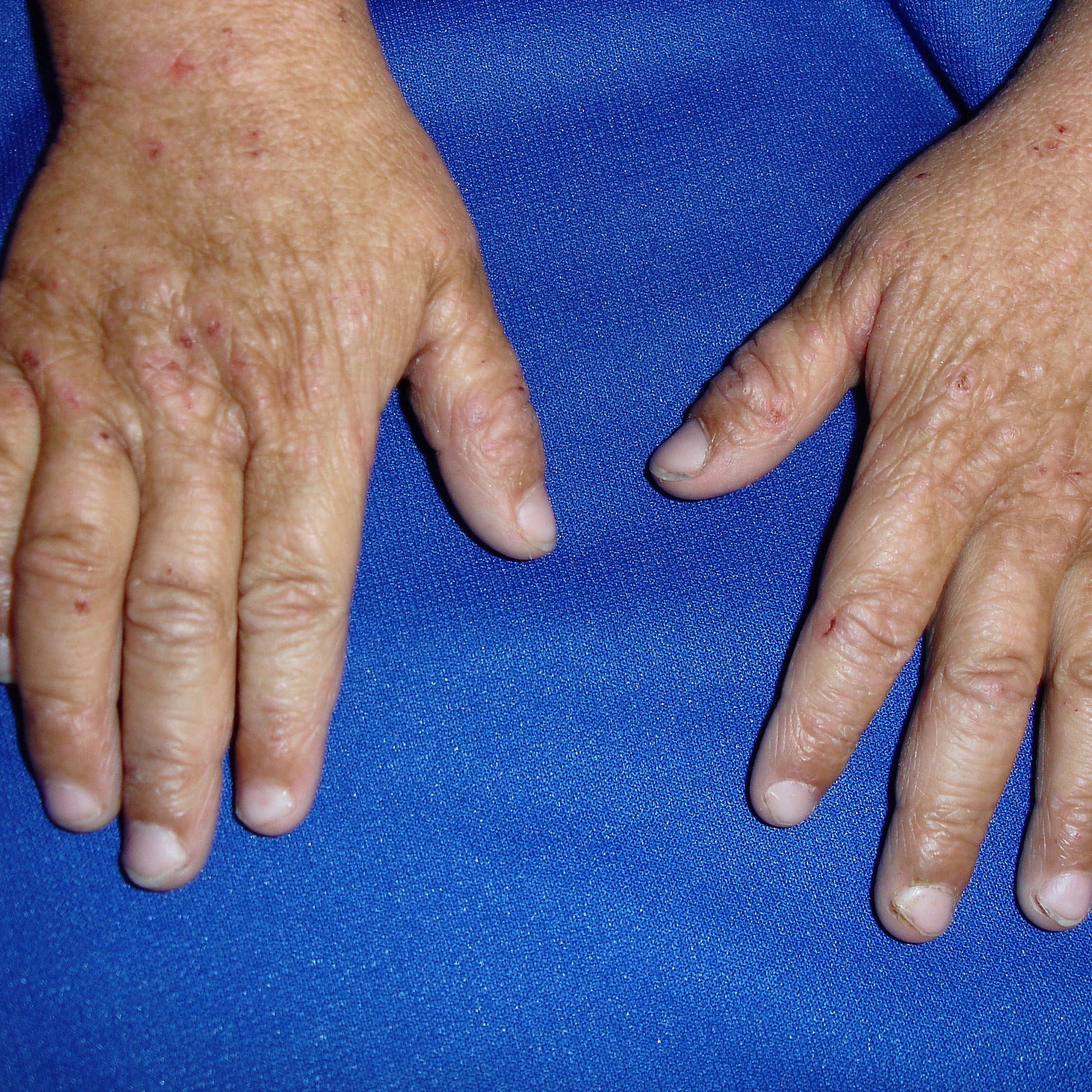 The Itch that Rashes: The Informed Approach to Managing Atopic Dermatitis (Eczema)” (Don’t Be Rash: The Pediatric Dermatology Podcast: 2025, Ep. 5)