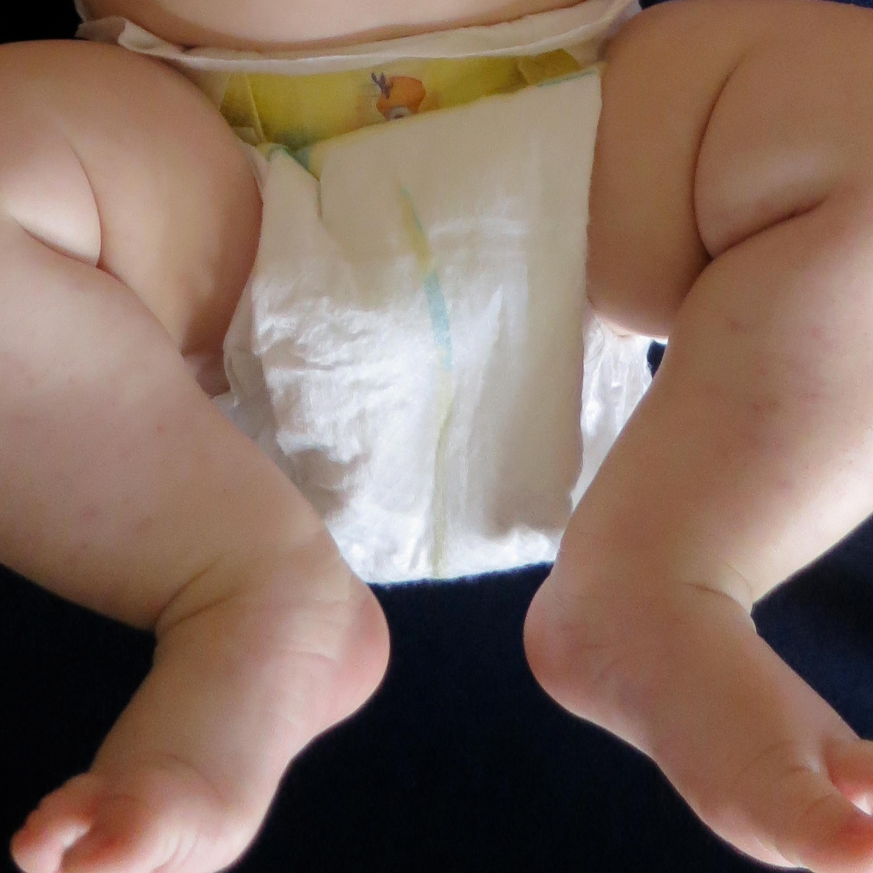 “Down in the Dumps:  The Approach to Diagnosing, Treating, and Preventing Diaper Dermatitis” (Don’t Be Rash: The Pediatric Dermatology Podcast: Y2026, Episode 1)