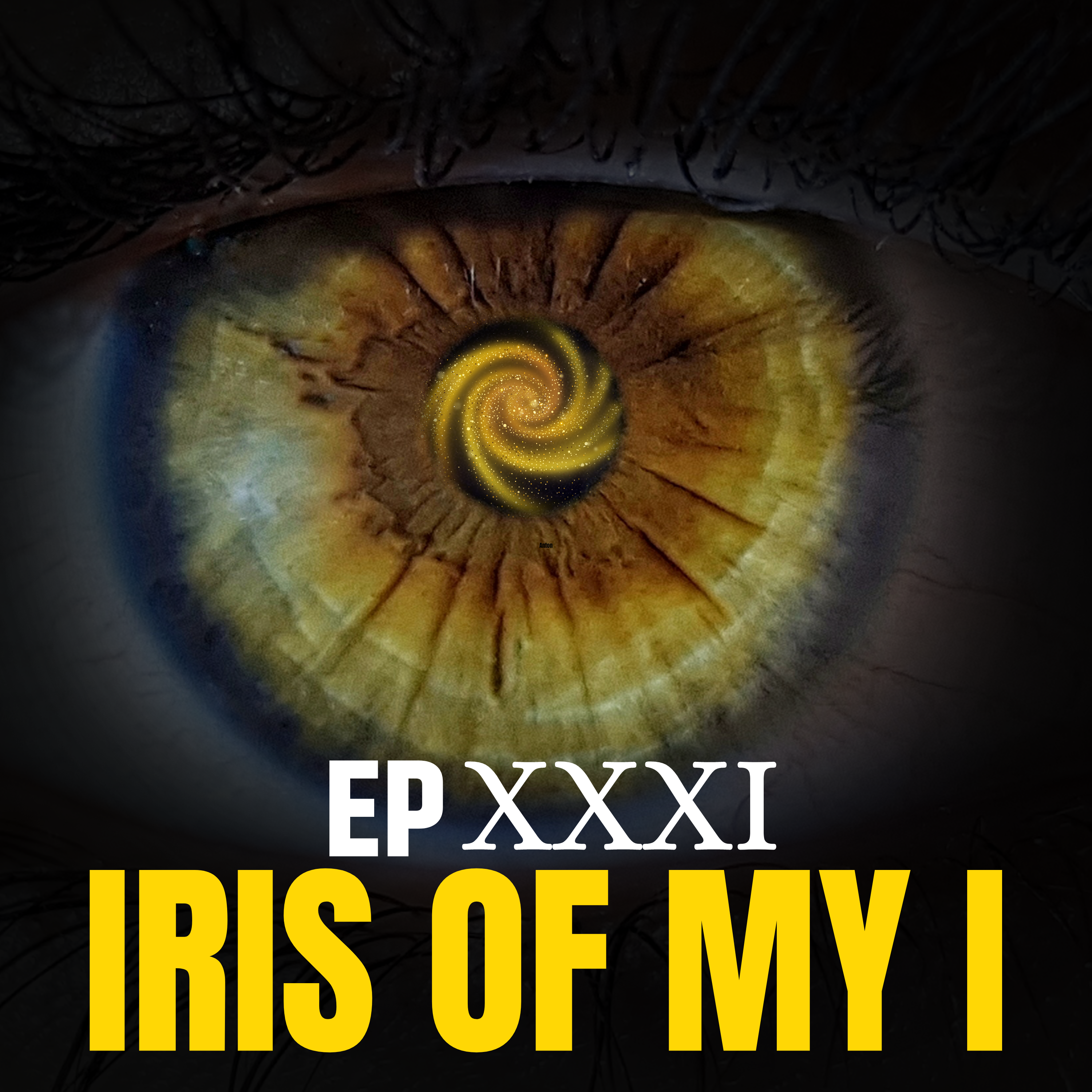 Iris of my I