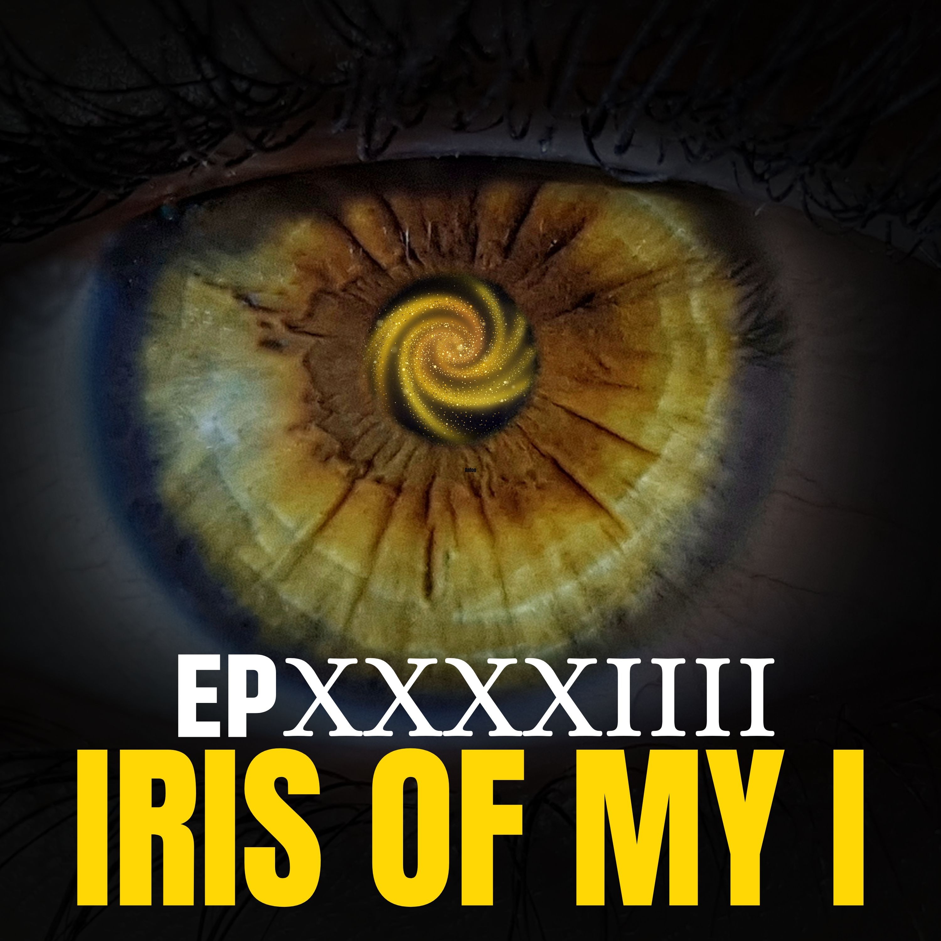 Iris of my I