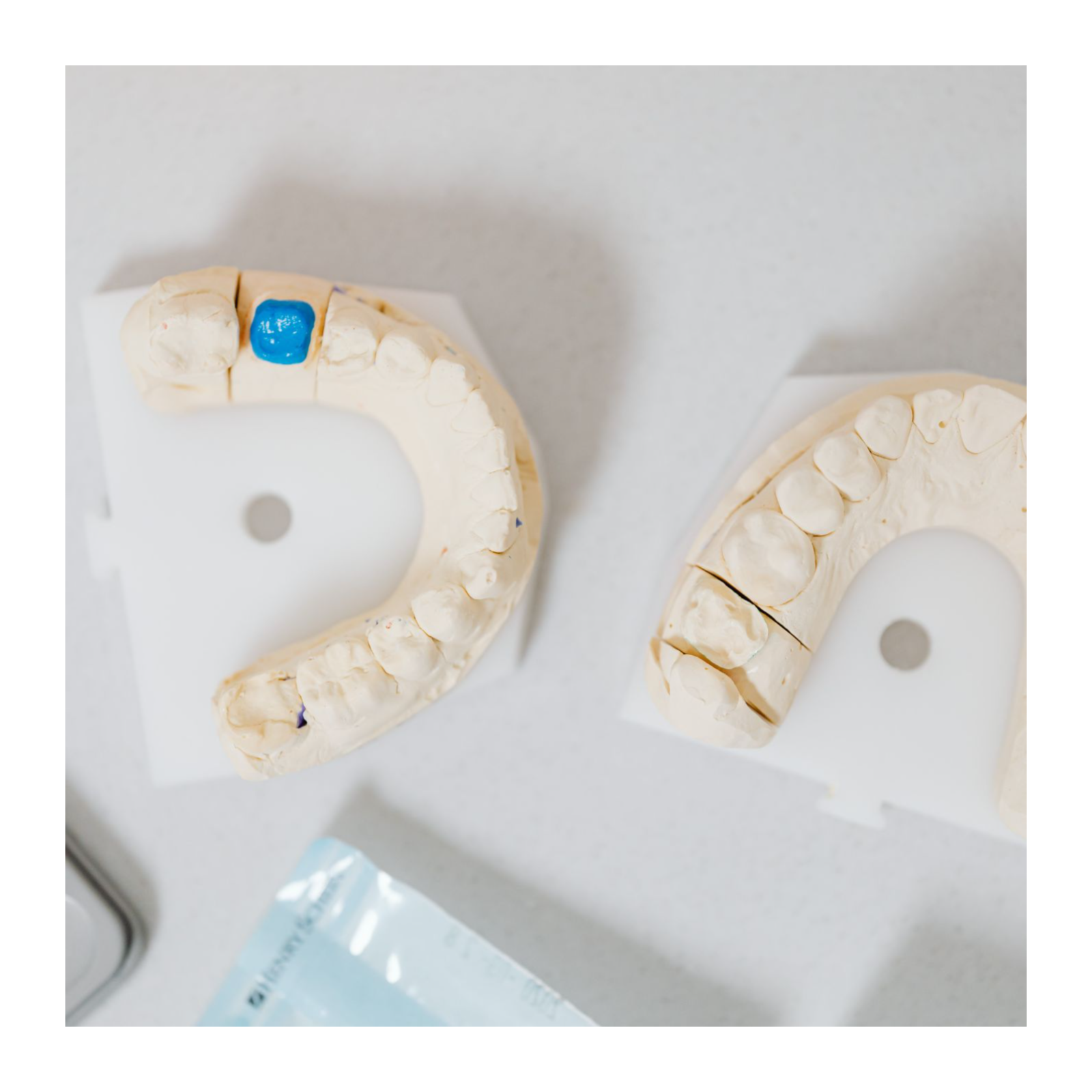 Eco Smiles: The Future of Sustainable Dentistry