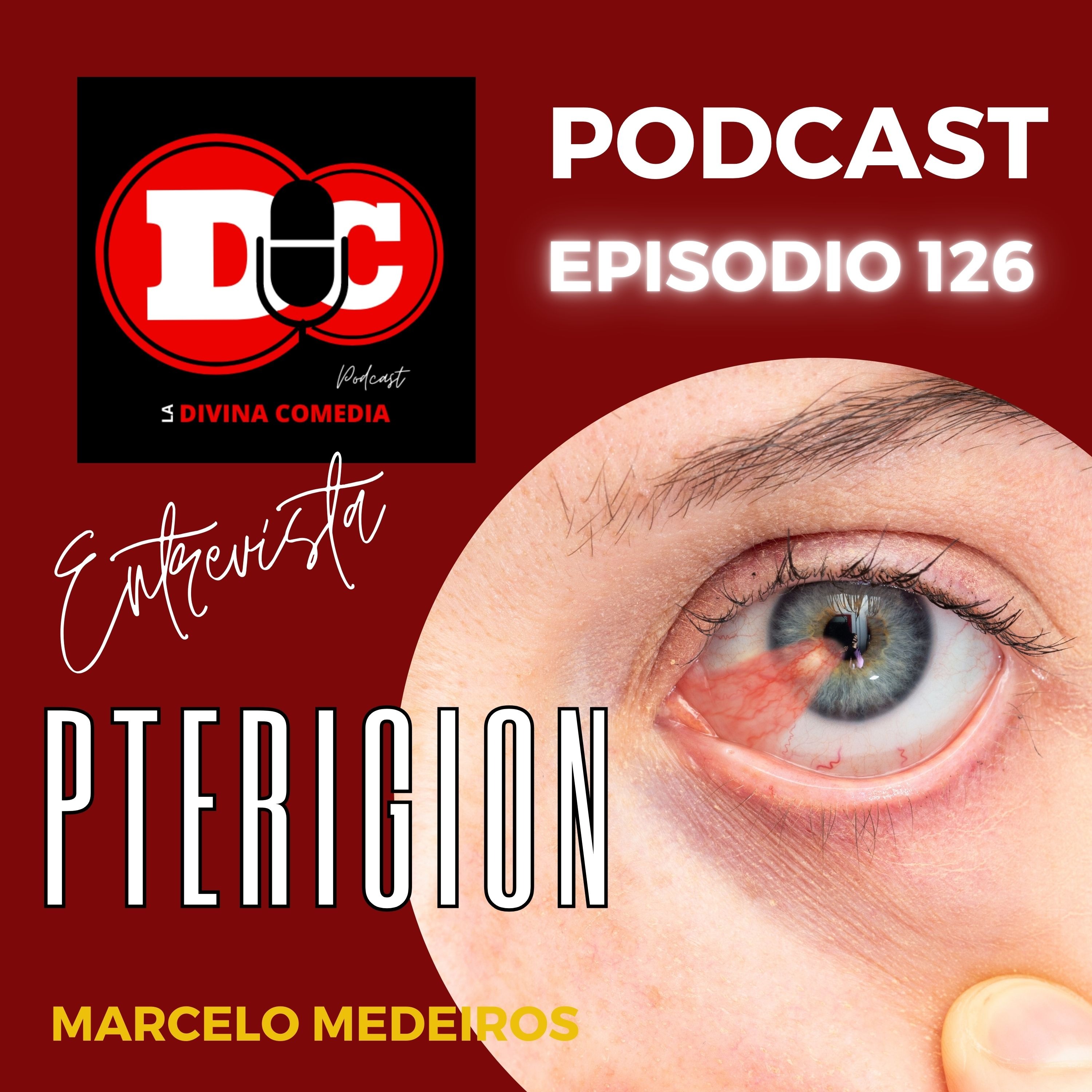 ENTREVISTA - Pterigión / Marcelo Medeiros