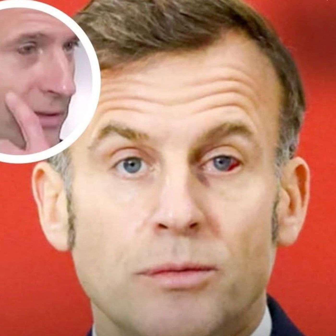 Francia24: Macron ha gli occhi rossi – Francia irriformabile, nessun limite agli “arrêt maladie” – Libretto A 1.5% – Meteo Week End Parigi episode artwork