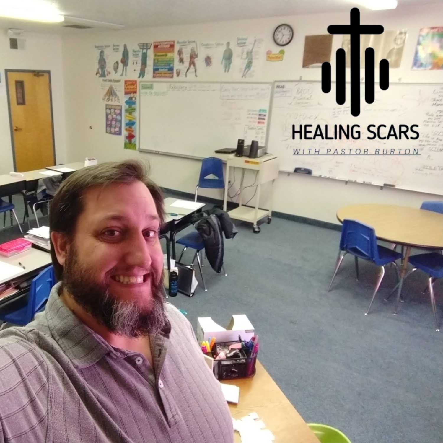 Healing Scars with Pastor Burton