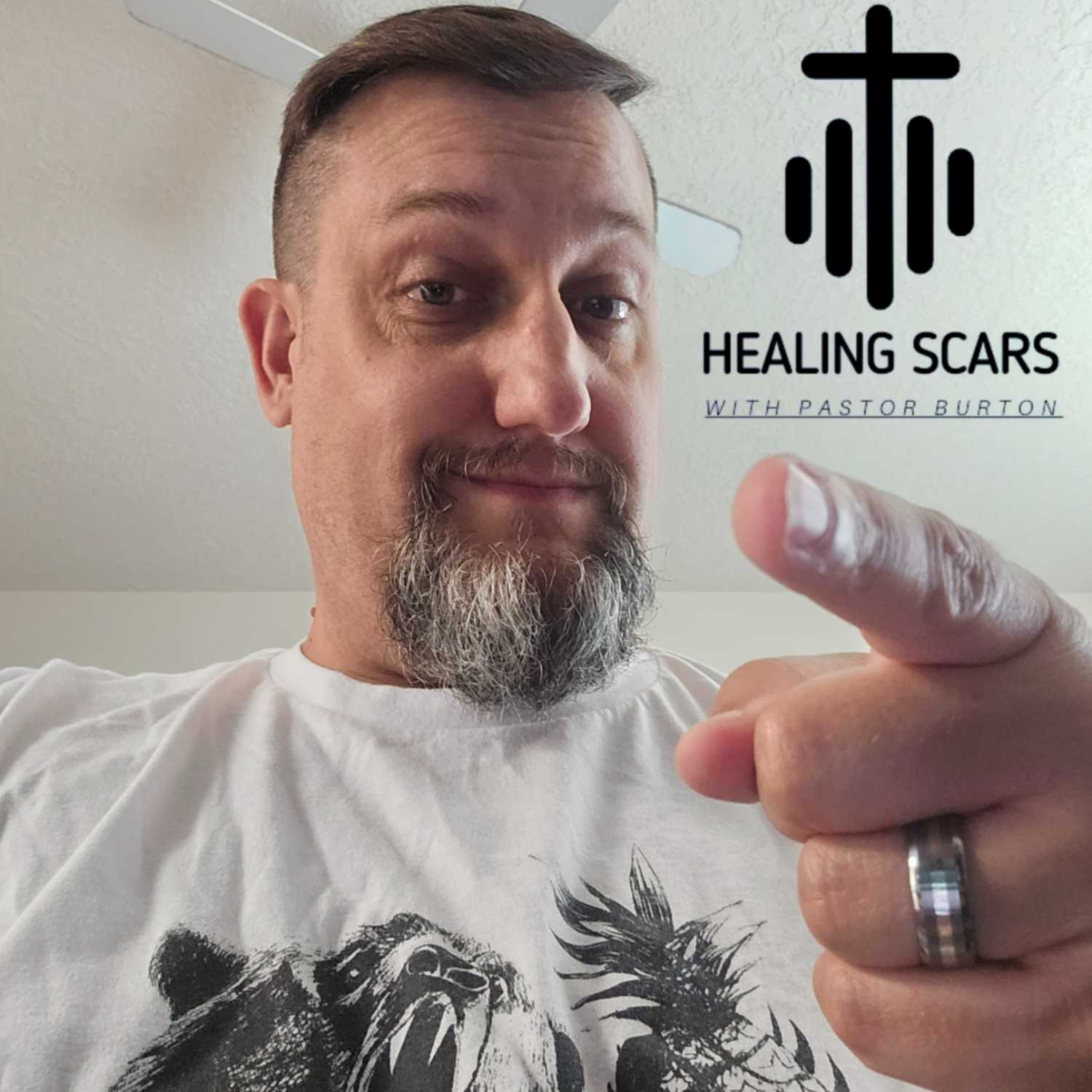 Healing Scars with Pastor Burton