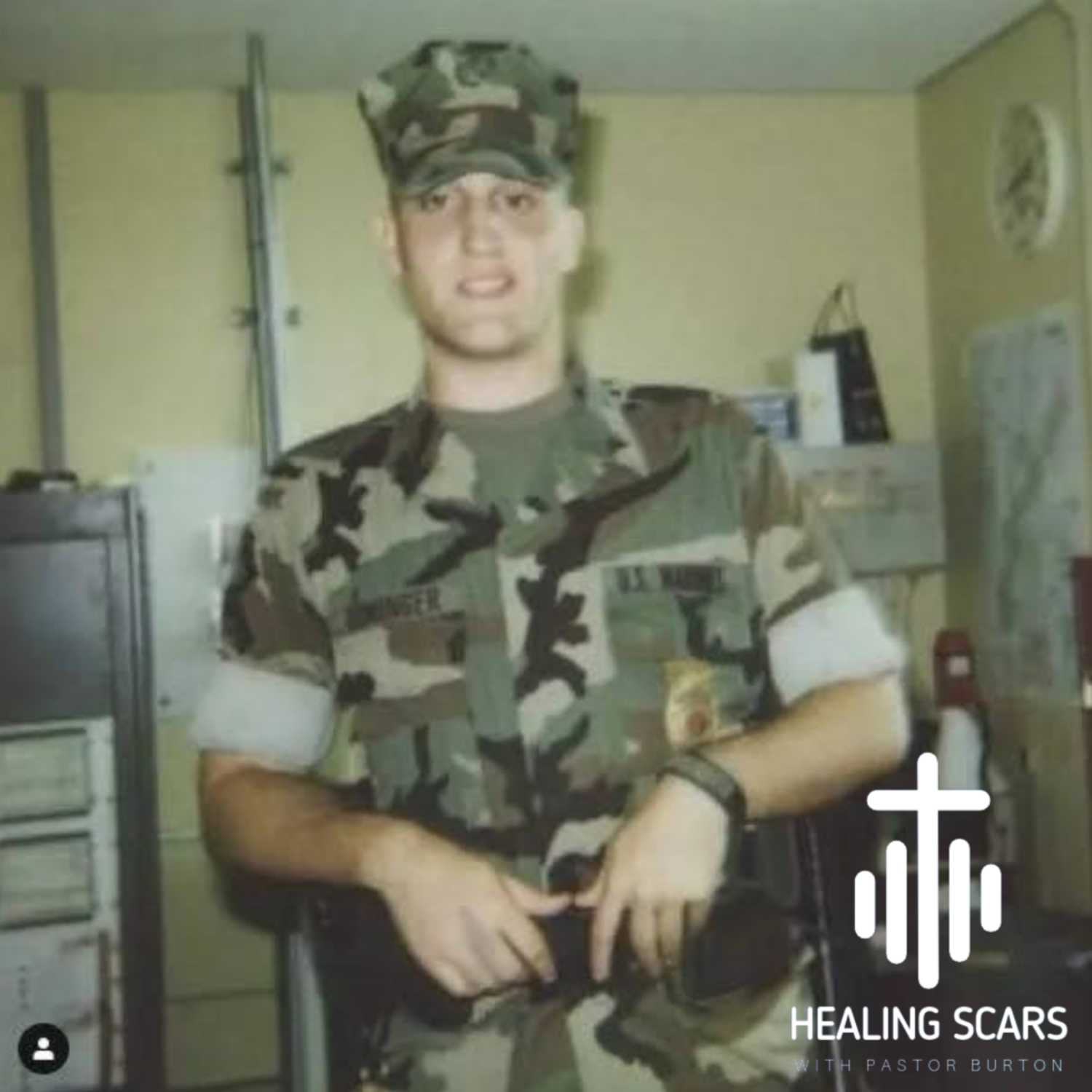 Healing Scars with Pastor Burton