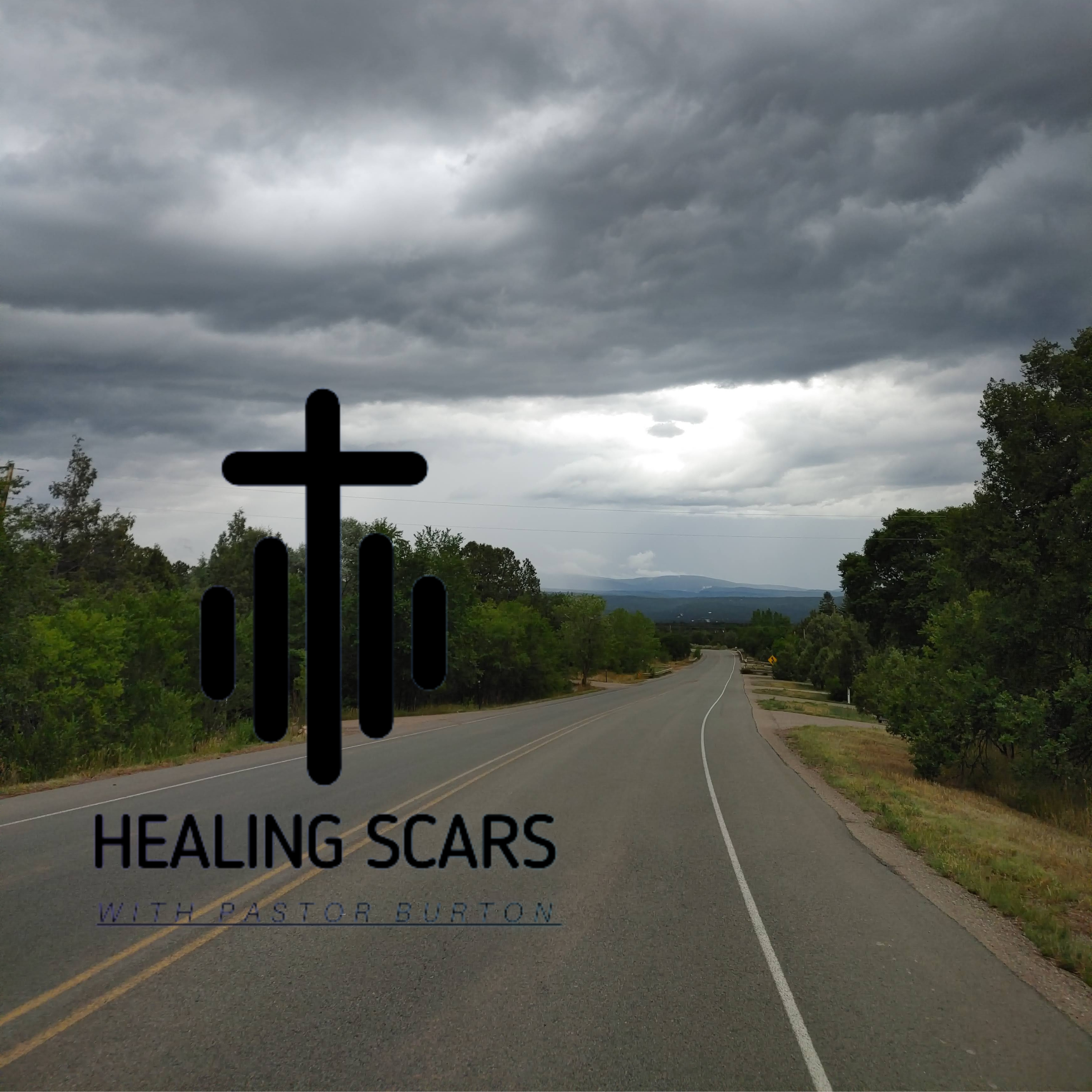 Healing Scars with Pastor Burton
