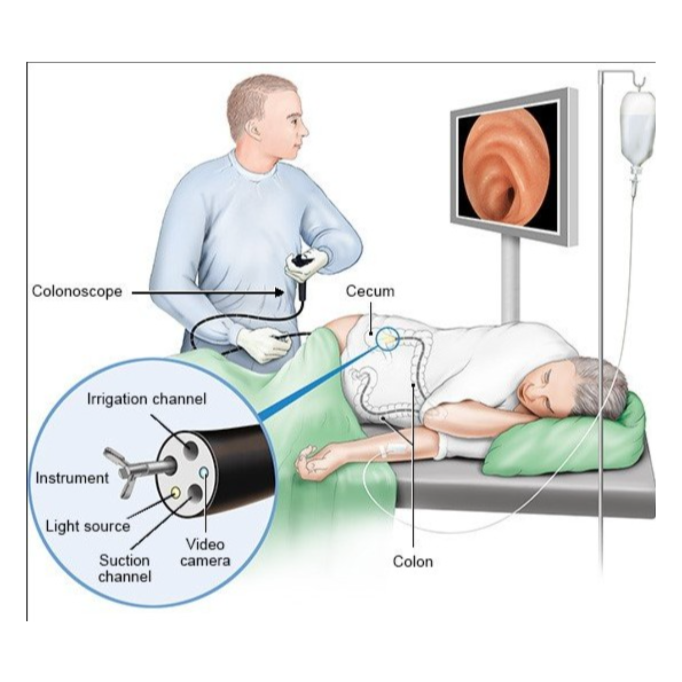 Bums and Benefits: My Colonoscopy via the NHS (National Health Service UK) episode artwork