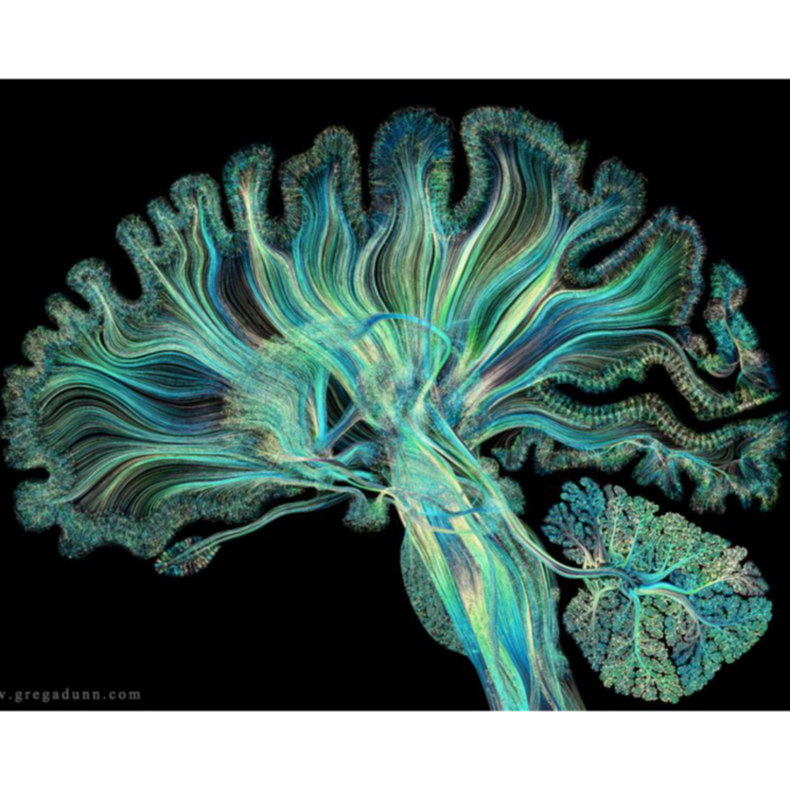 [Podcast] Ep 1: Inside The Brain-Computer