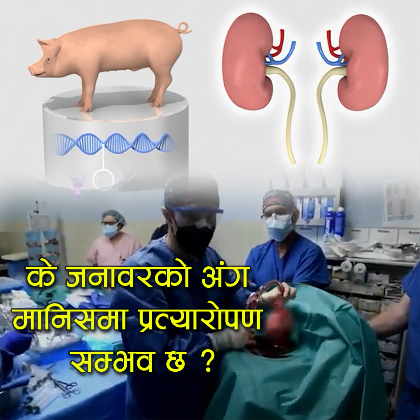Can animal organs be transplanted into humans? : Kantipur Explained episode artwork