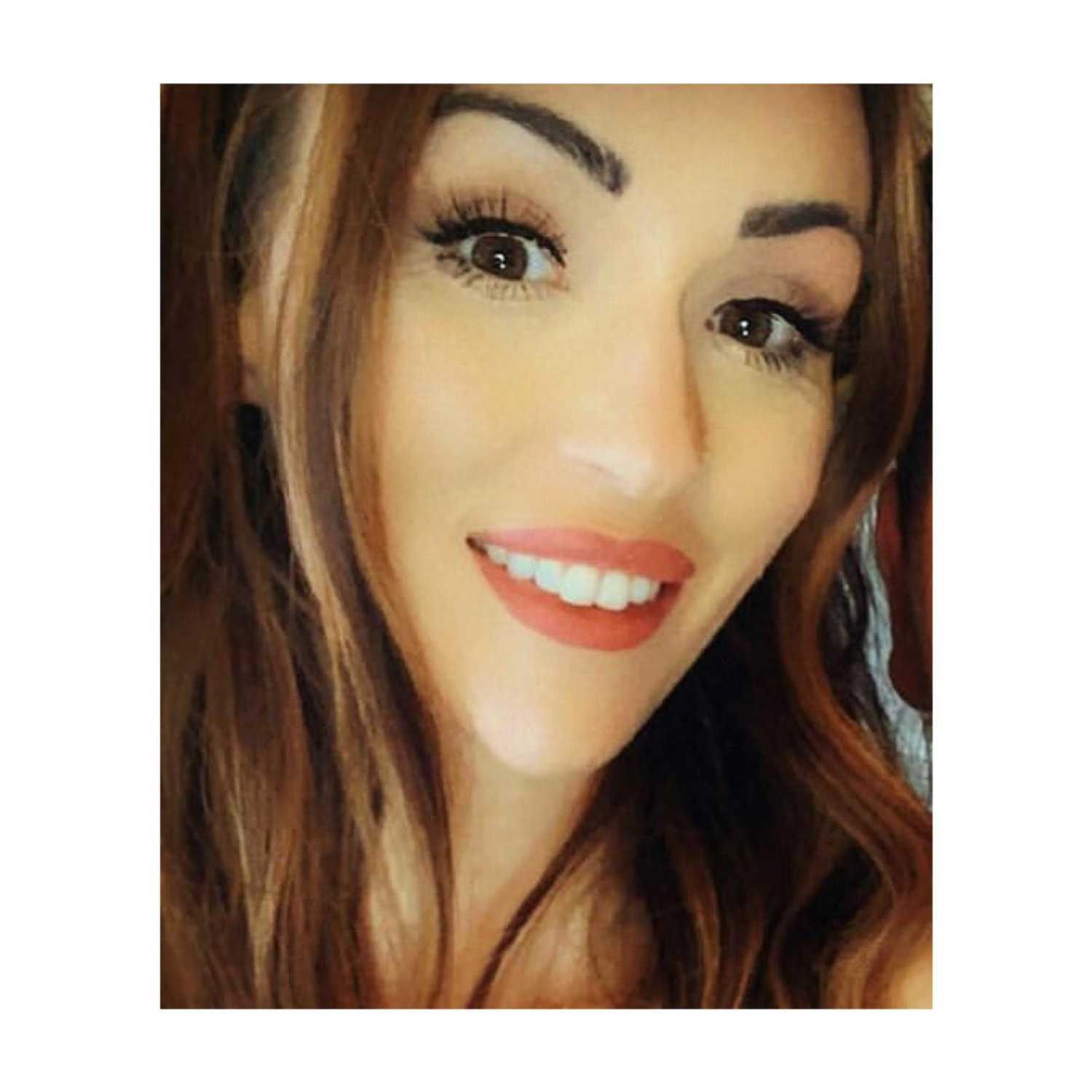 Burns; our Staci Louise. It's her story! Burns; our Staci Louise. It's her story!