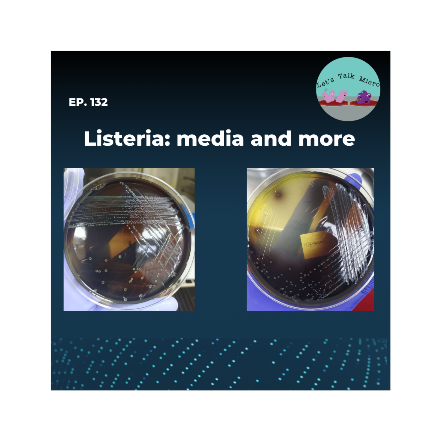 132: Listeria: media and more