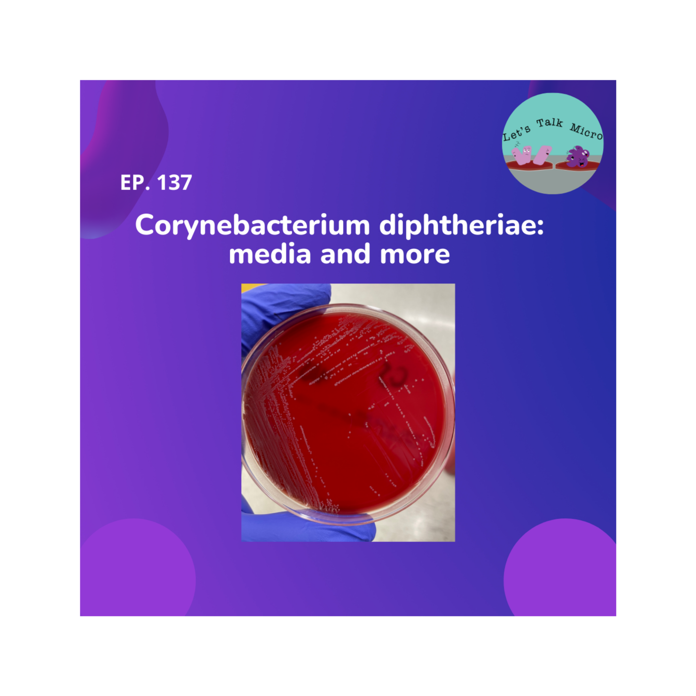 137: Corynebacterium diphtheriae: media and more