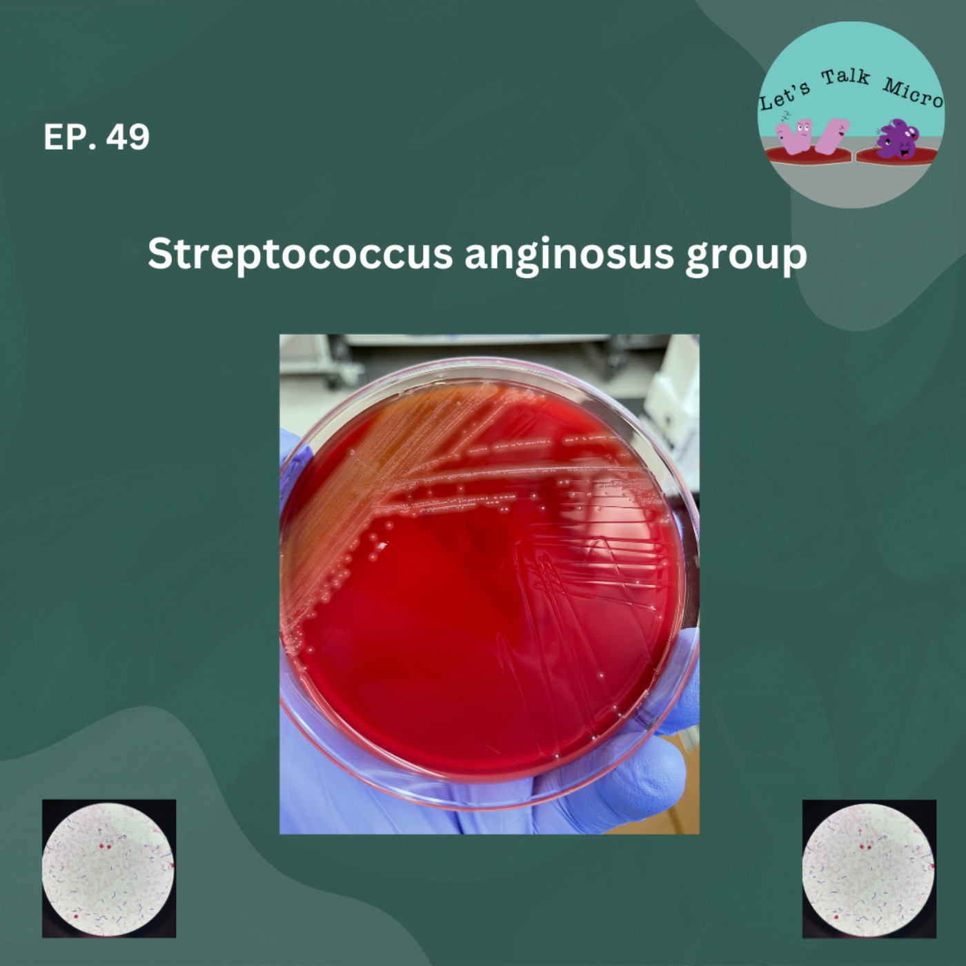 TBT: Streptococcus anginosus group