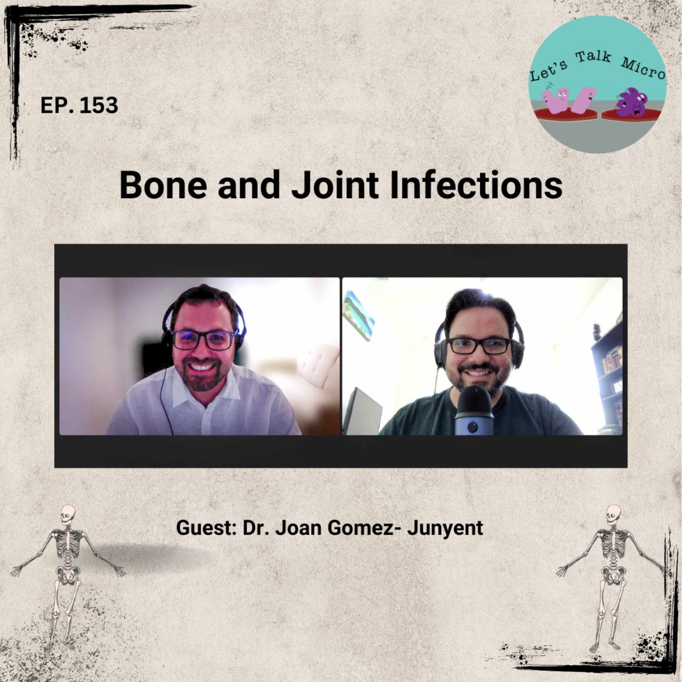 153: Bone and Joint Infections