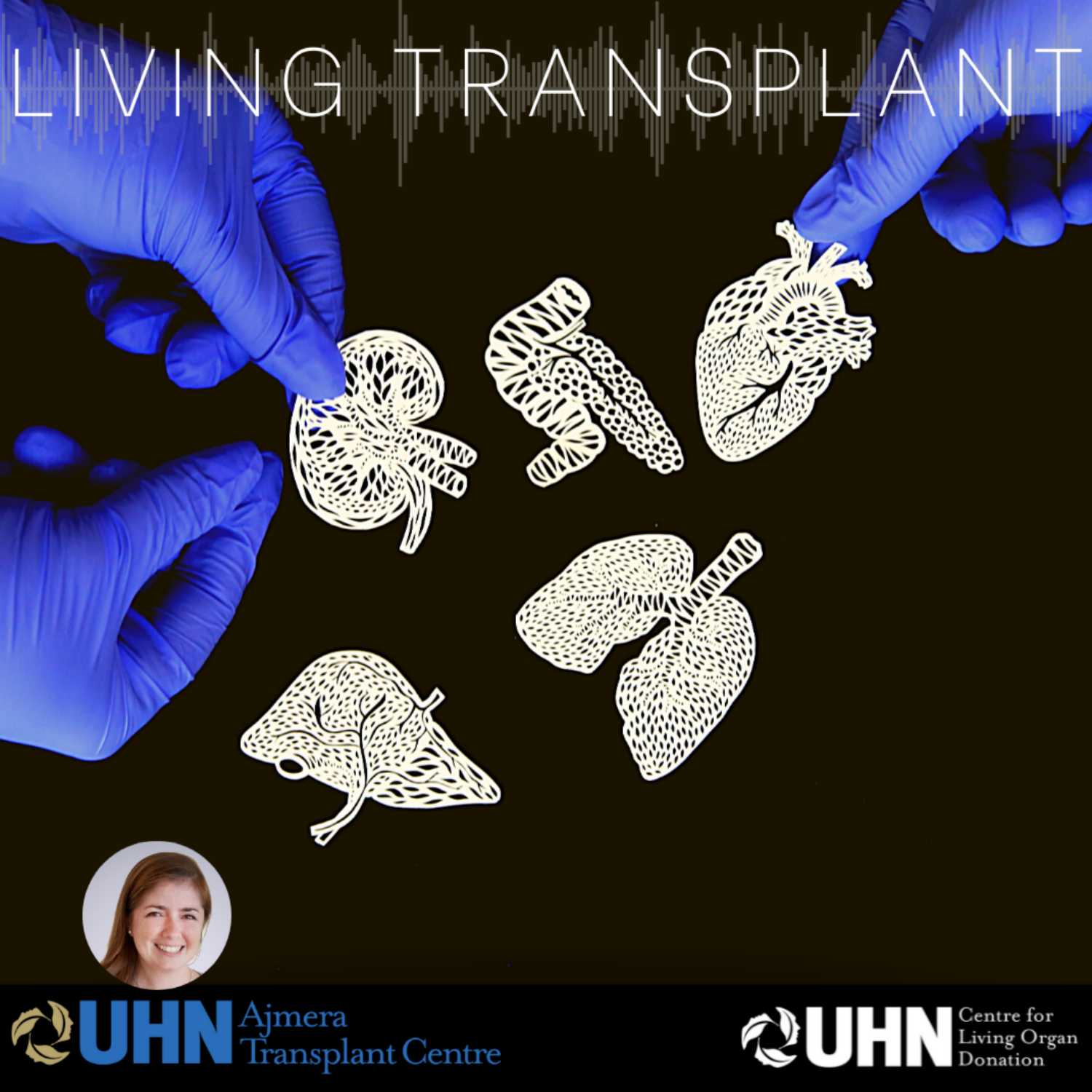 Living Transplant