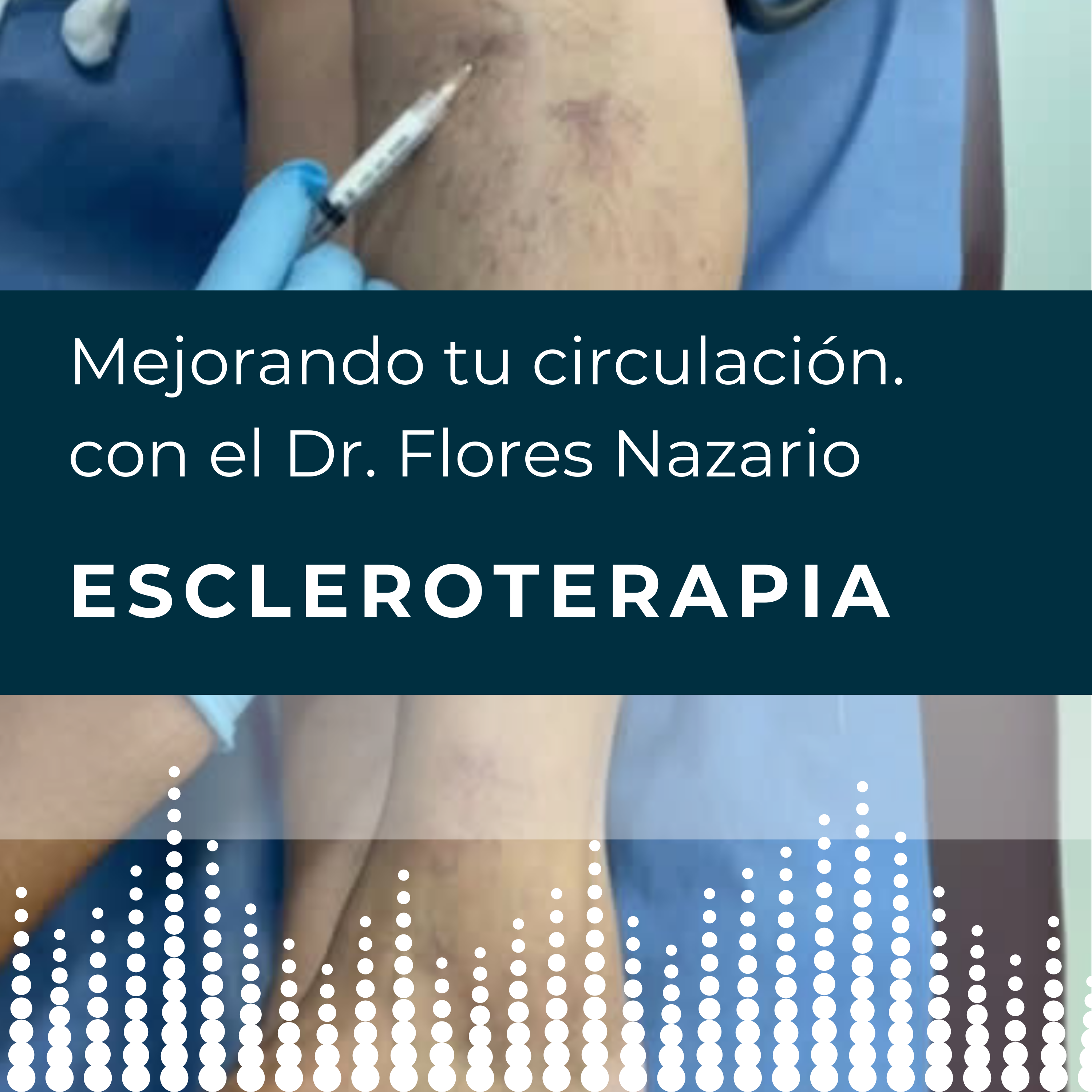 Circulando.