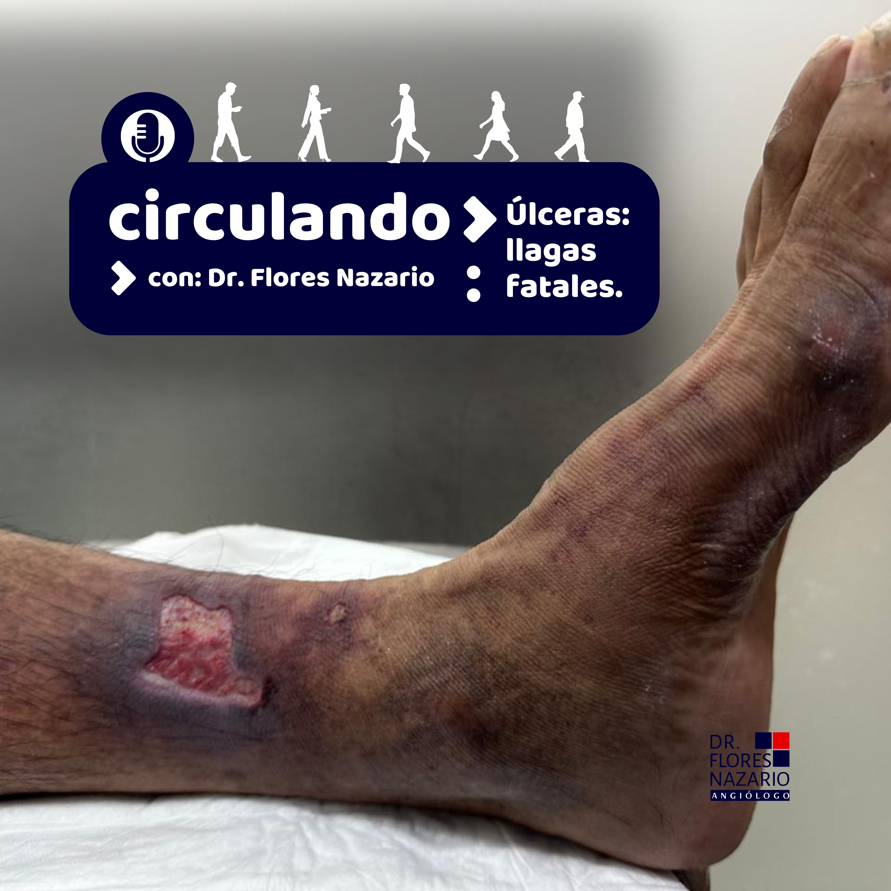 Circulando.