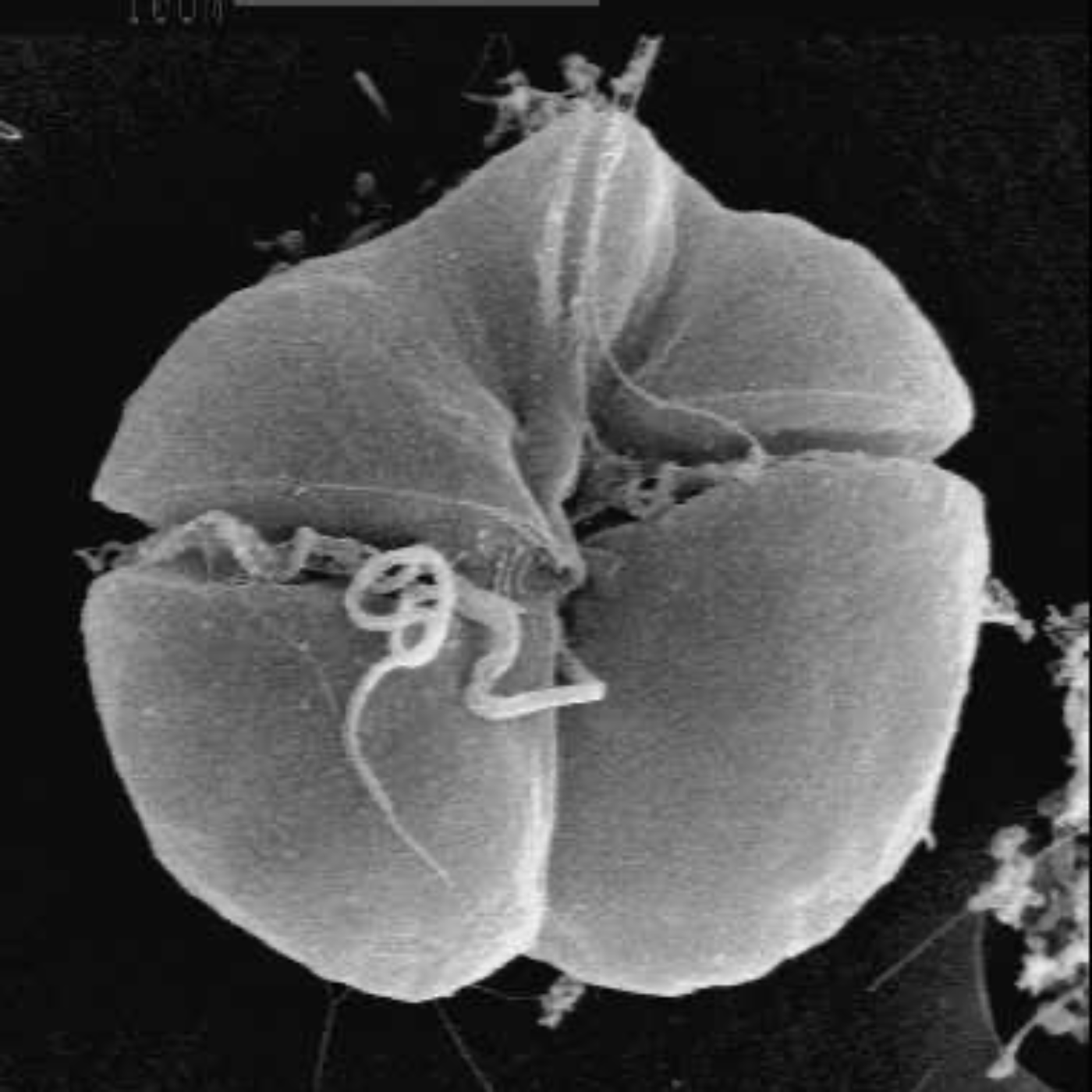 Escalating Red Tide Algae Bloom in Florida and its Impacts