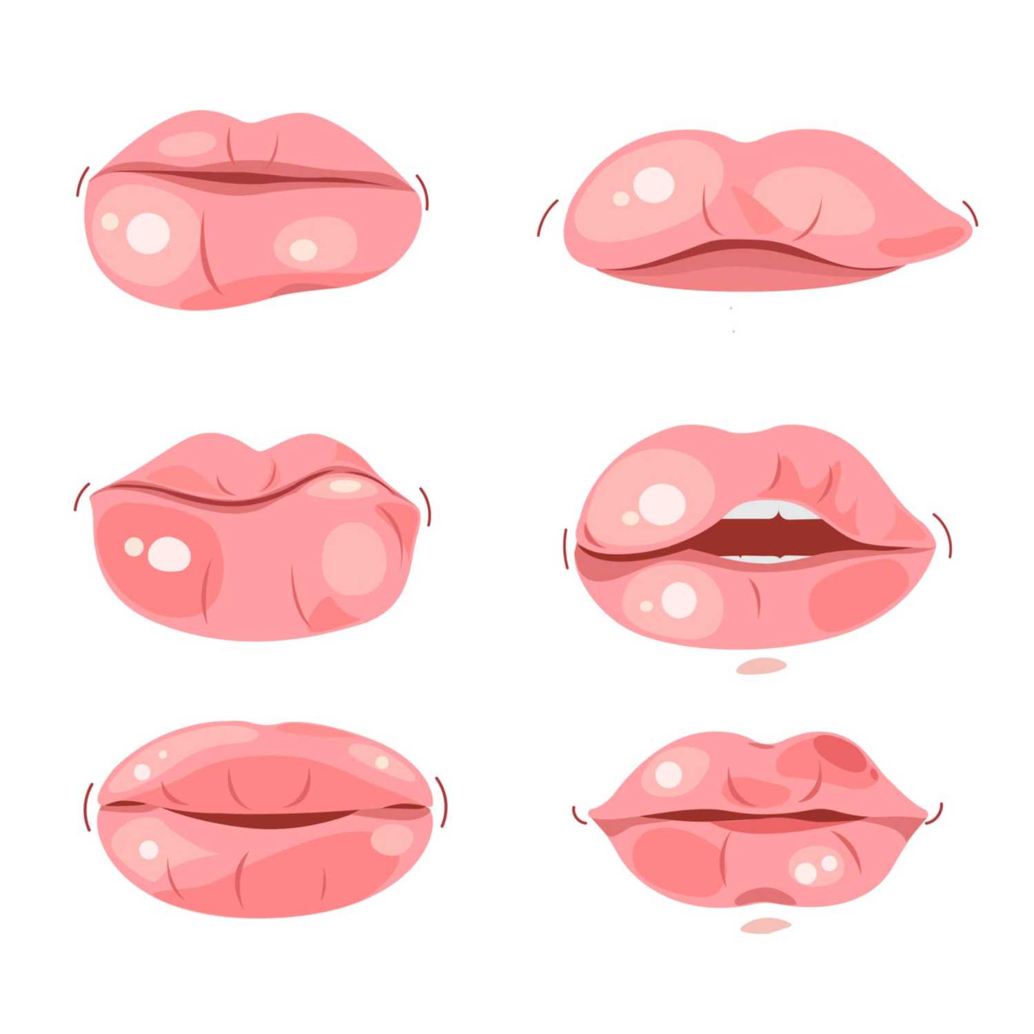 What can cause a bump on the lip? episode artwork