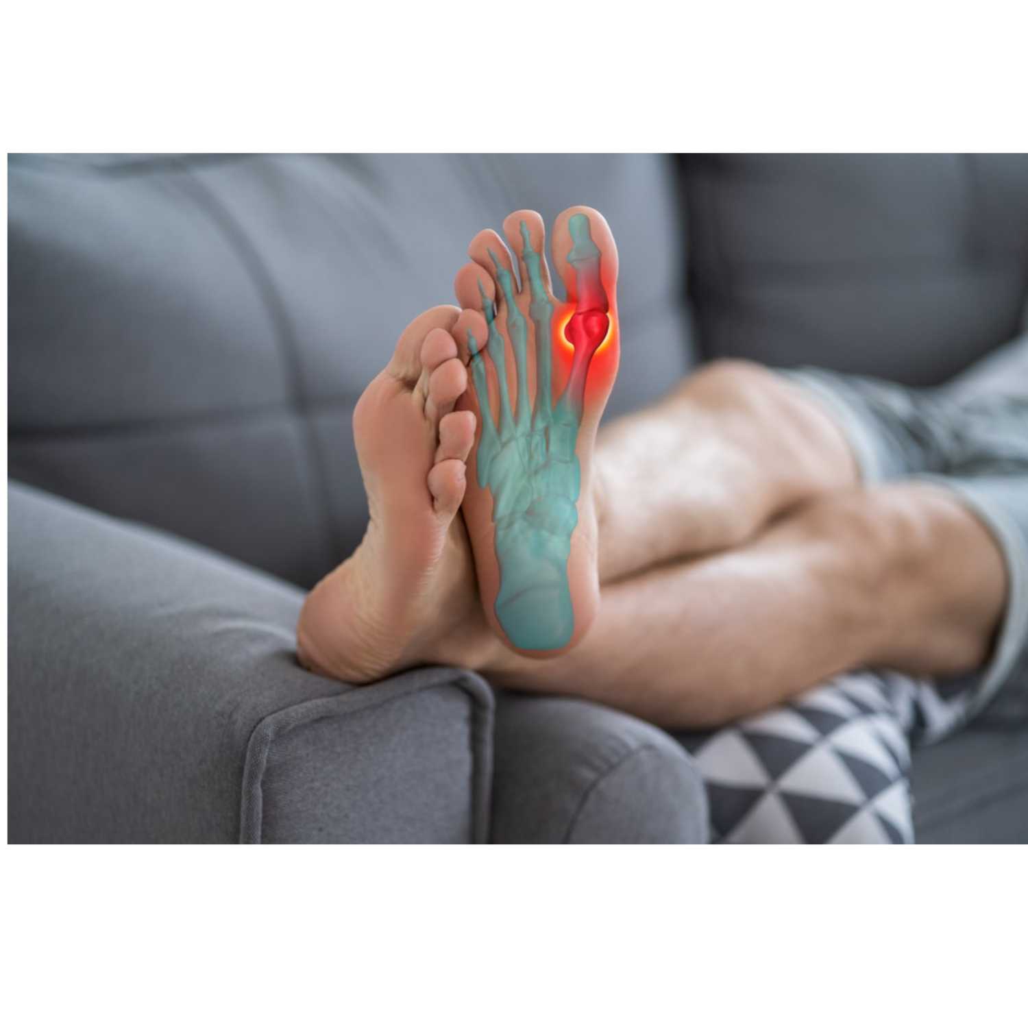 10 home remedies for gout episode artwork