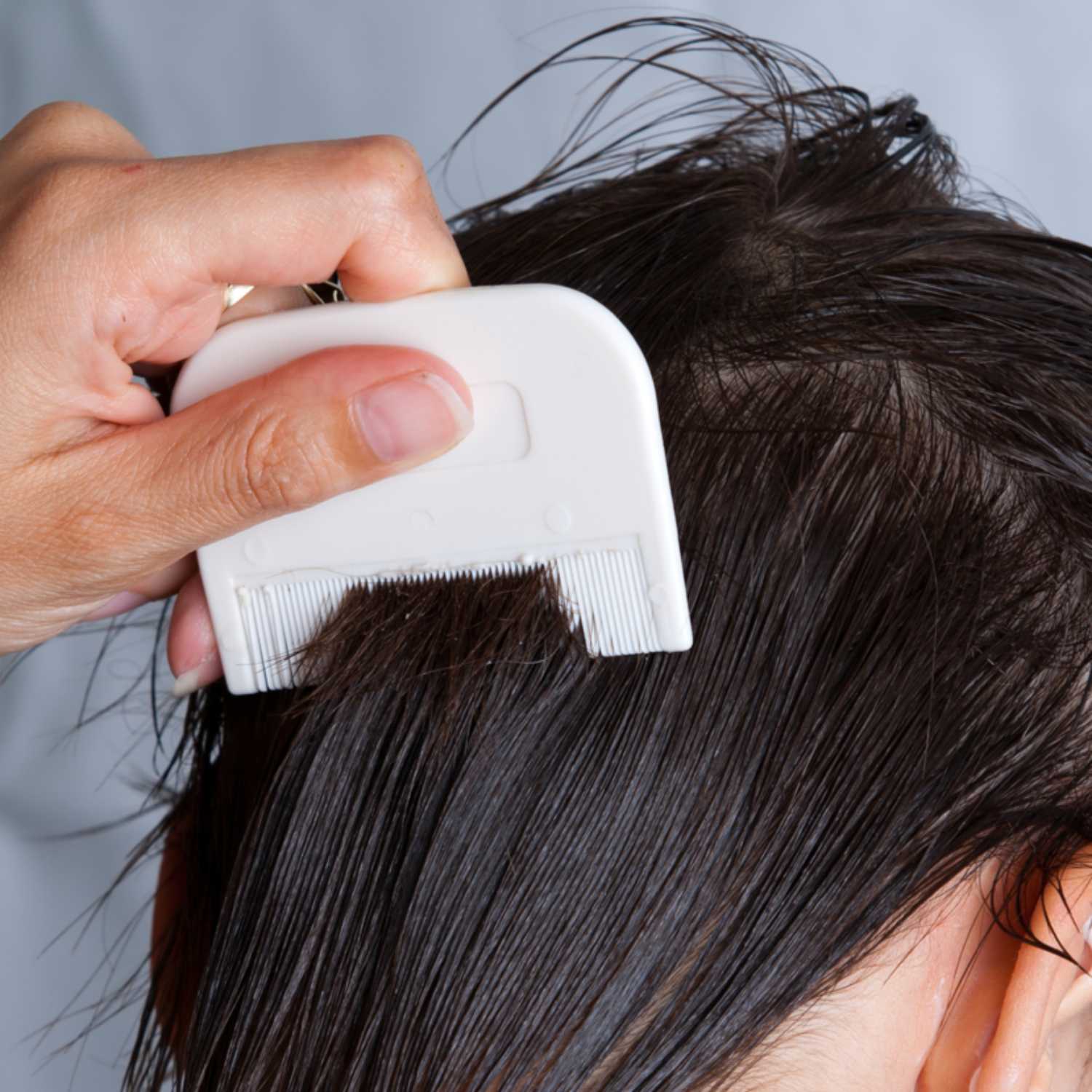 Home Remedies for Lice: 11 Ways to Treat Lice Naturally episode artwork