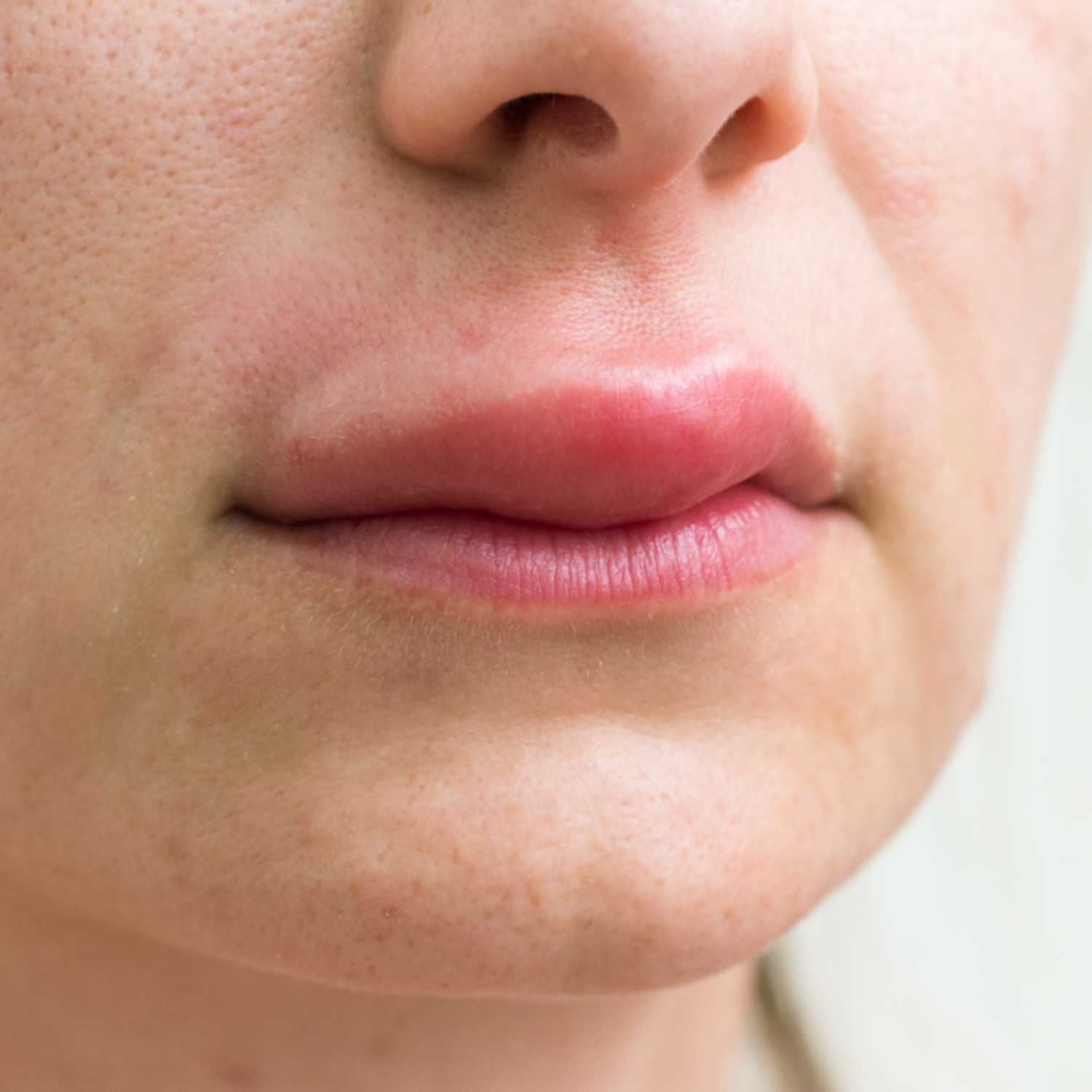 How to Get Rid of Swollen Lips episode artwork