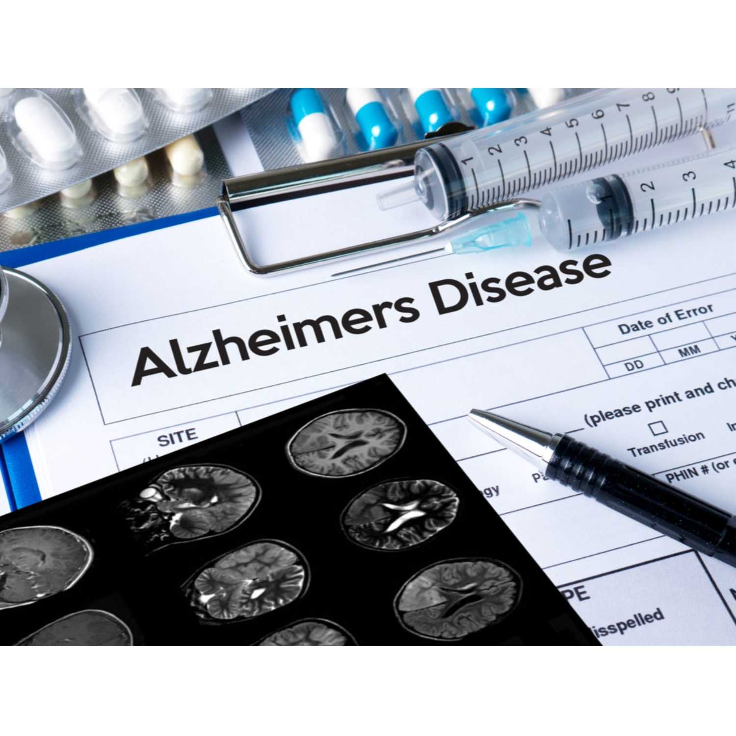 Testosterone May Be Protective Against Alzheimer’s Disease episode artwork